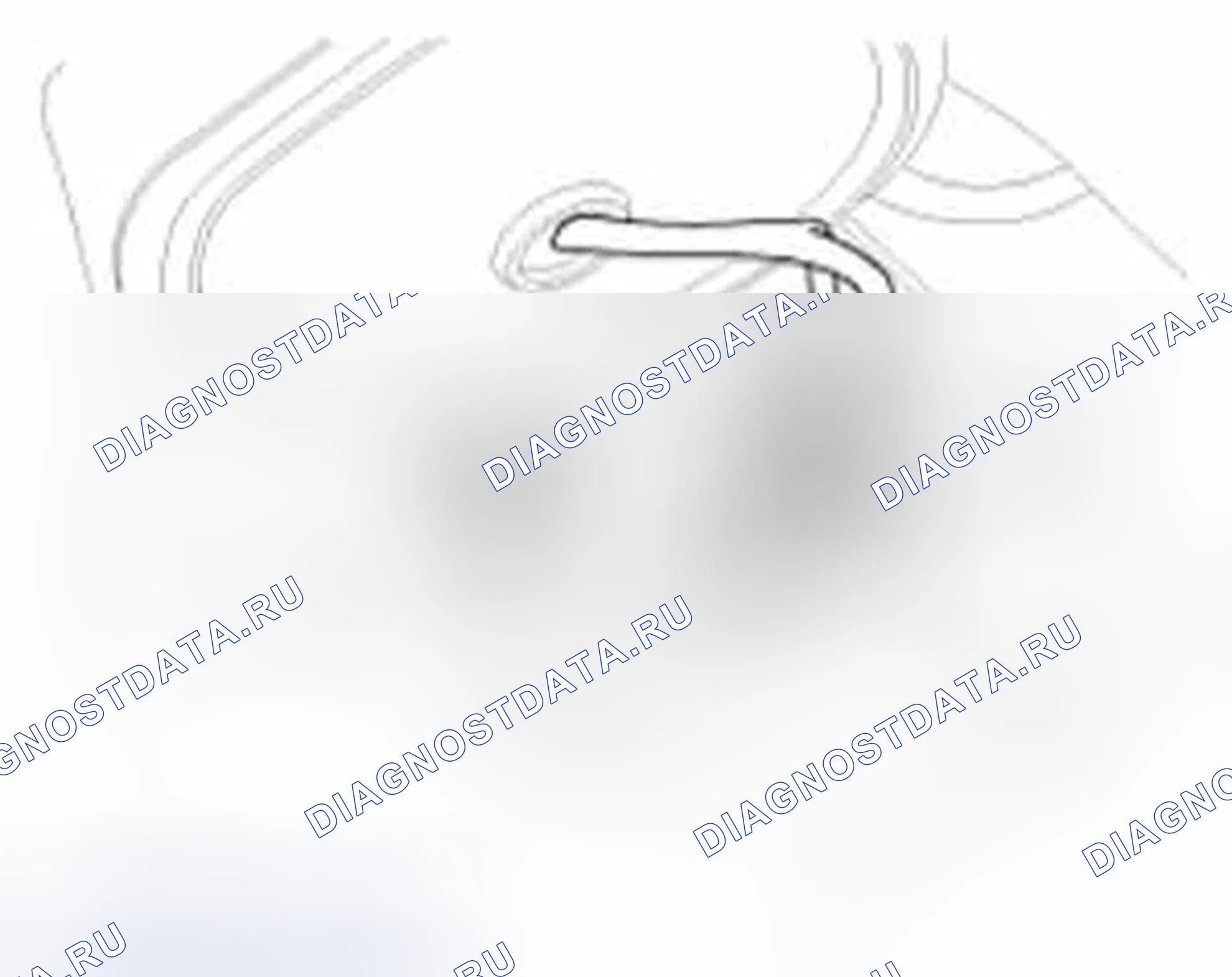 Рис. 38. Hyundai Veloster I