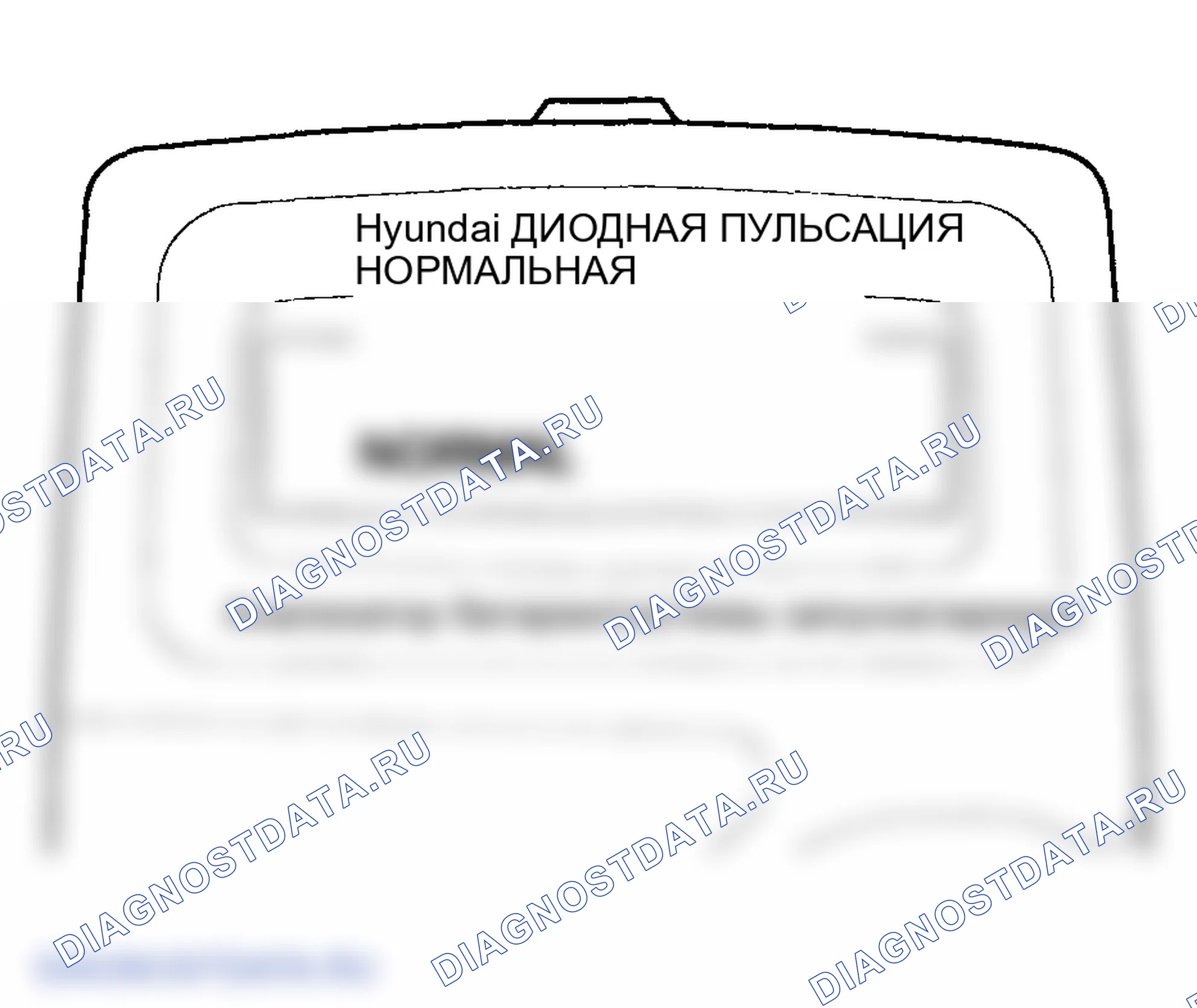 Рис. 24. Hyundai Elantra III рестайлинг