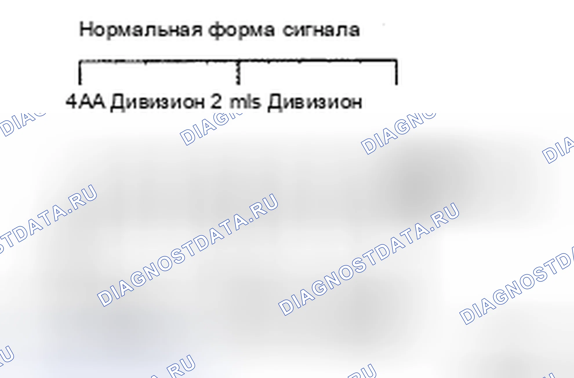Рис. 69. Toyota Avalon XX30 рестайлинг