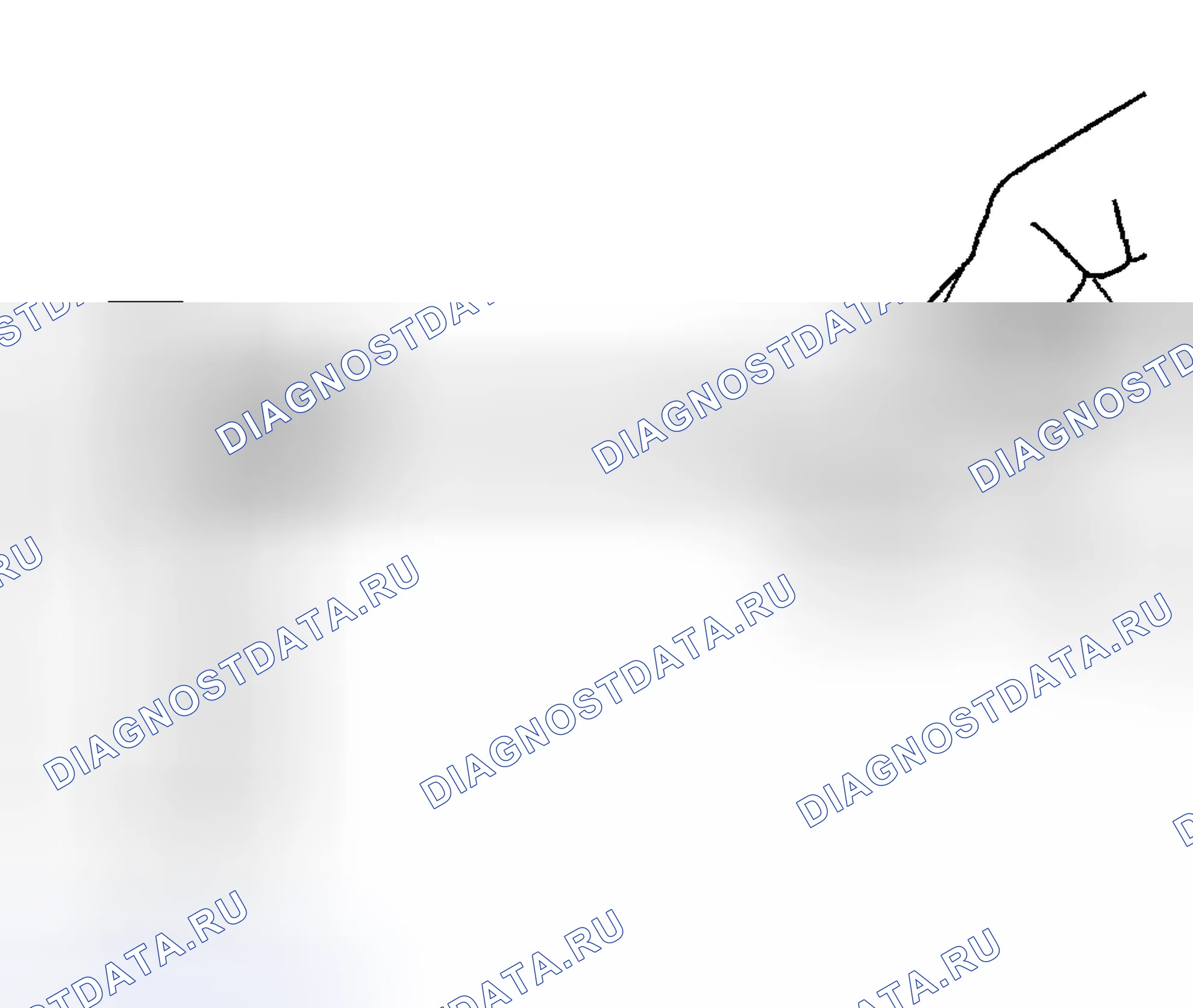 Рис. 143. Hyundai Tiburon II рестайлинг