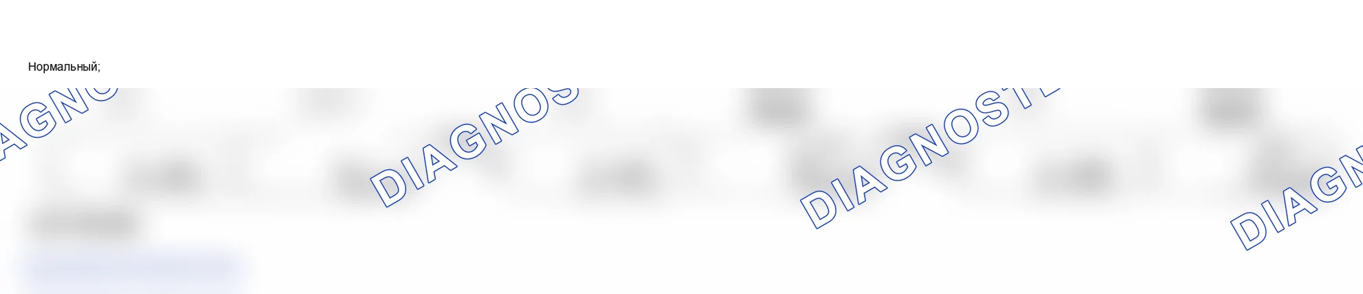 Рис. 2. Honda Odyssey II