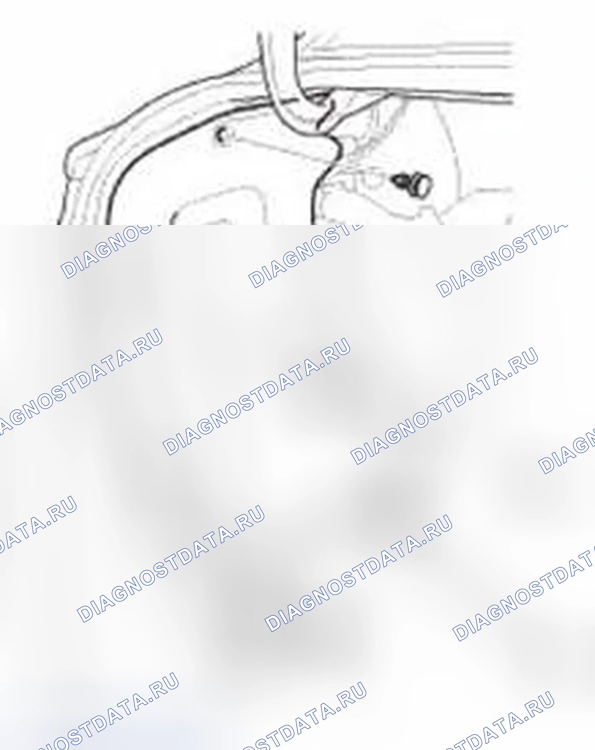 Рис. 175. Honda Civic IX