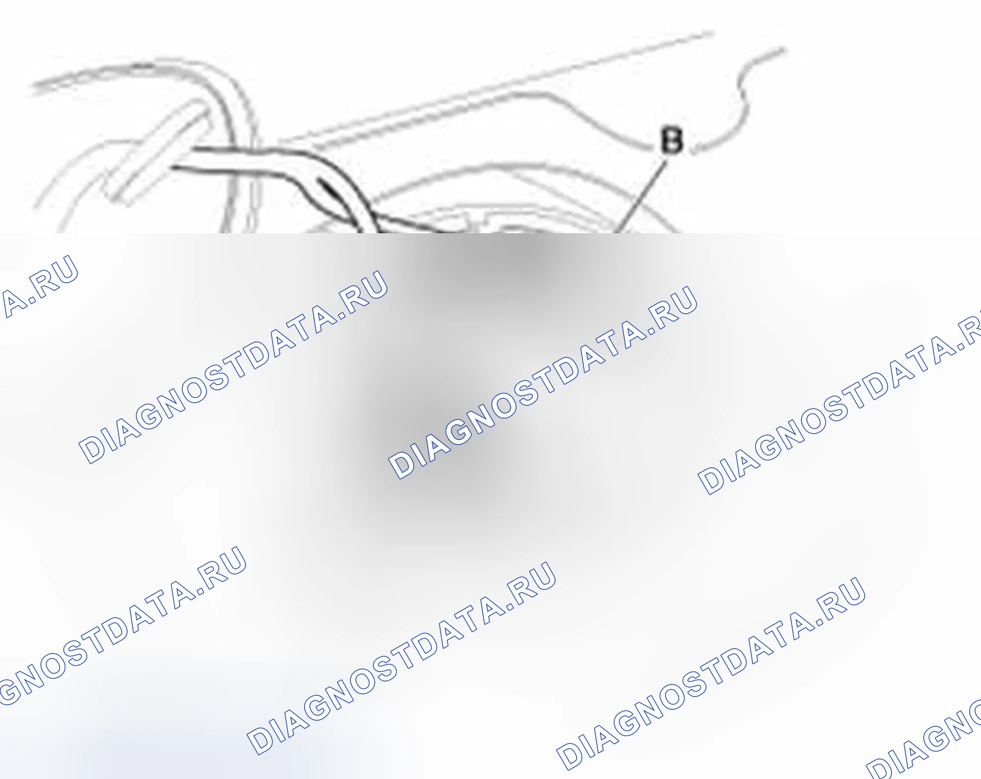 Рис. 40. Hyundai Elantra V