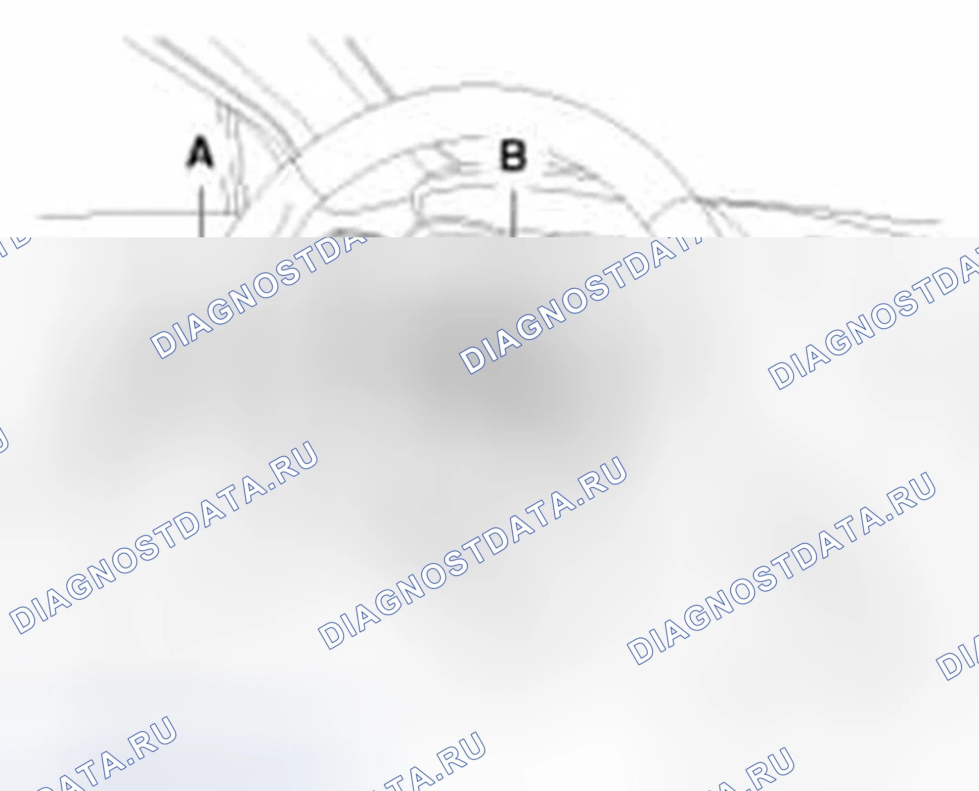 Рис. 10. Hyundai Elantra V
