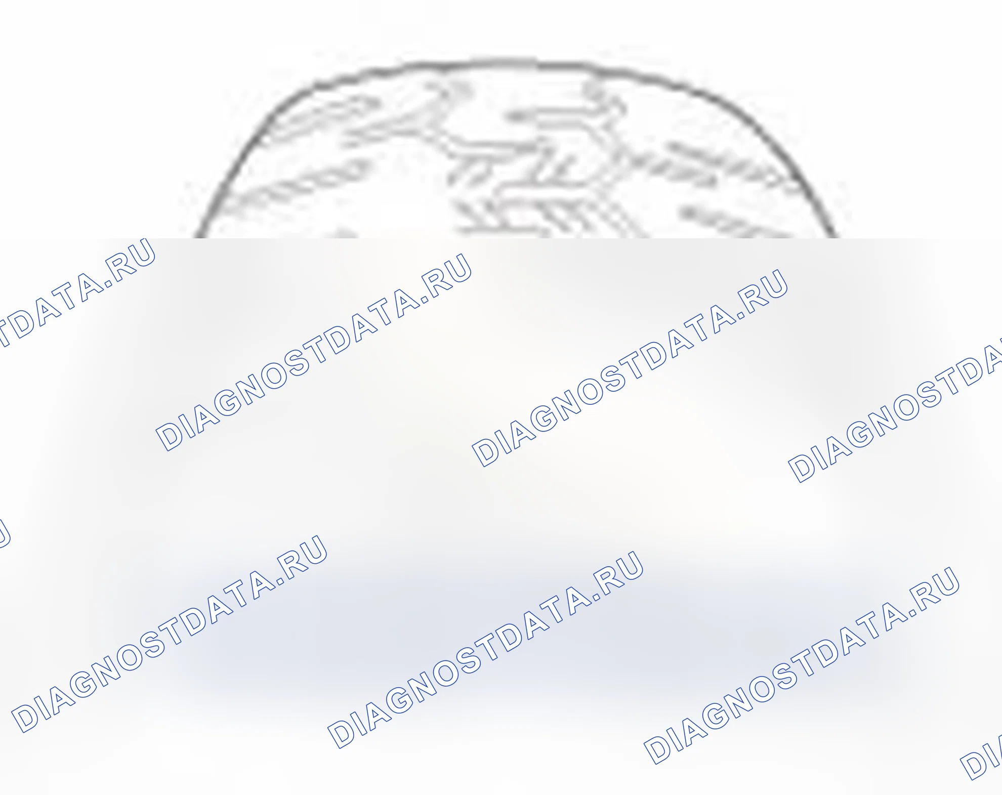 Рис. 49. Hyundai Elantra V