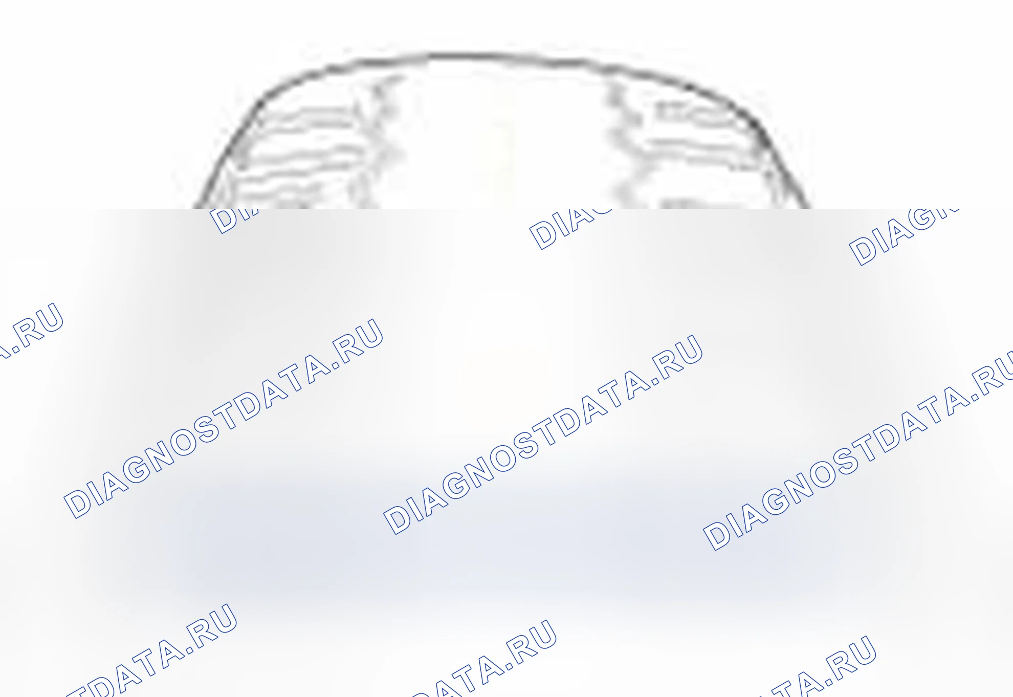 Рис. 38. Hyundai Veloster I
