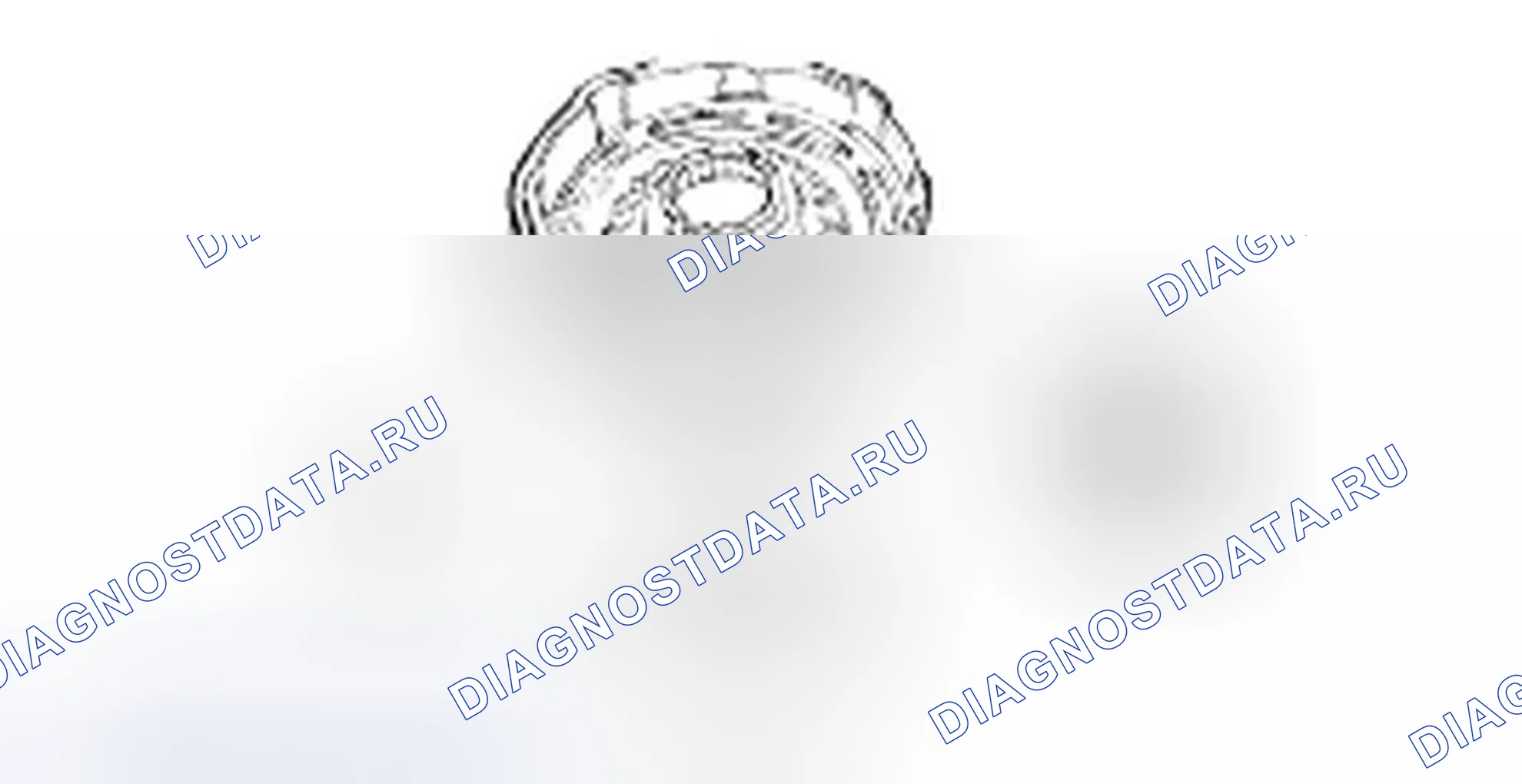 Разборка прямого сцепления. Hyundai H-1 A1