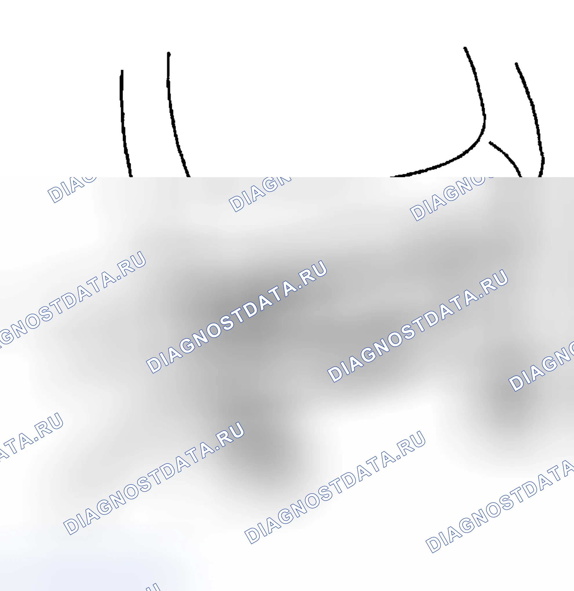 Рис. 96: Процедура установки. Hyundai Terracan I