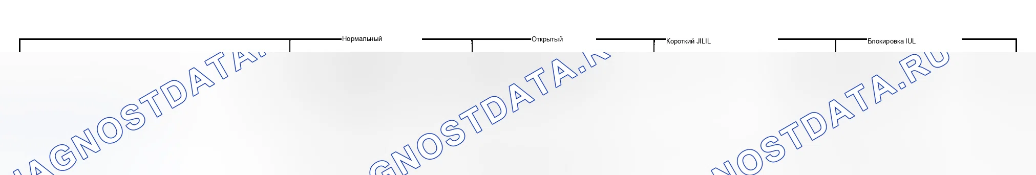 Рис. 104. Suzuki Grand Vitara I рестайлинг
