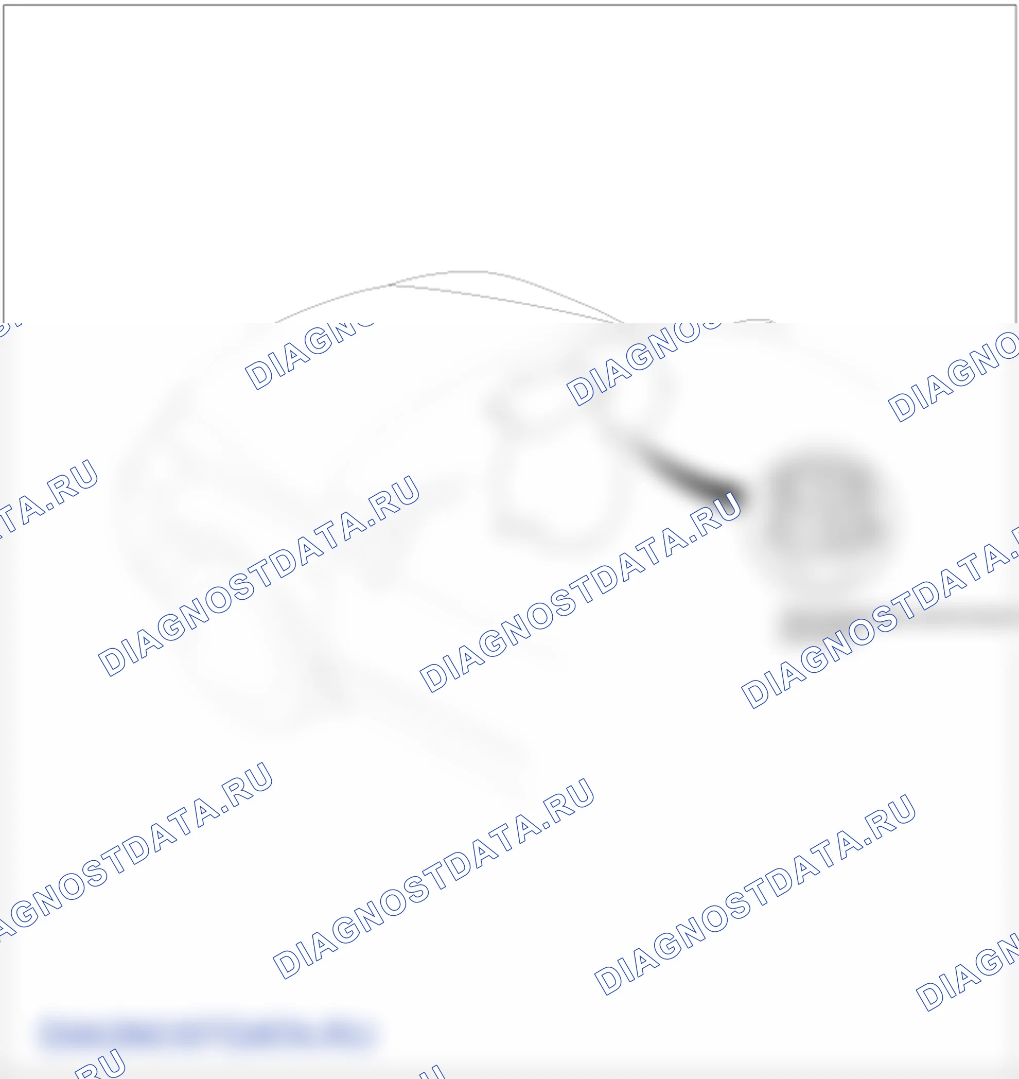 Расположение деталей электродвигателя вентилятора отопителя. Hyundai Santa Fe CM