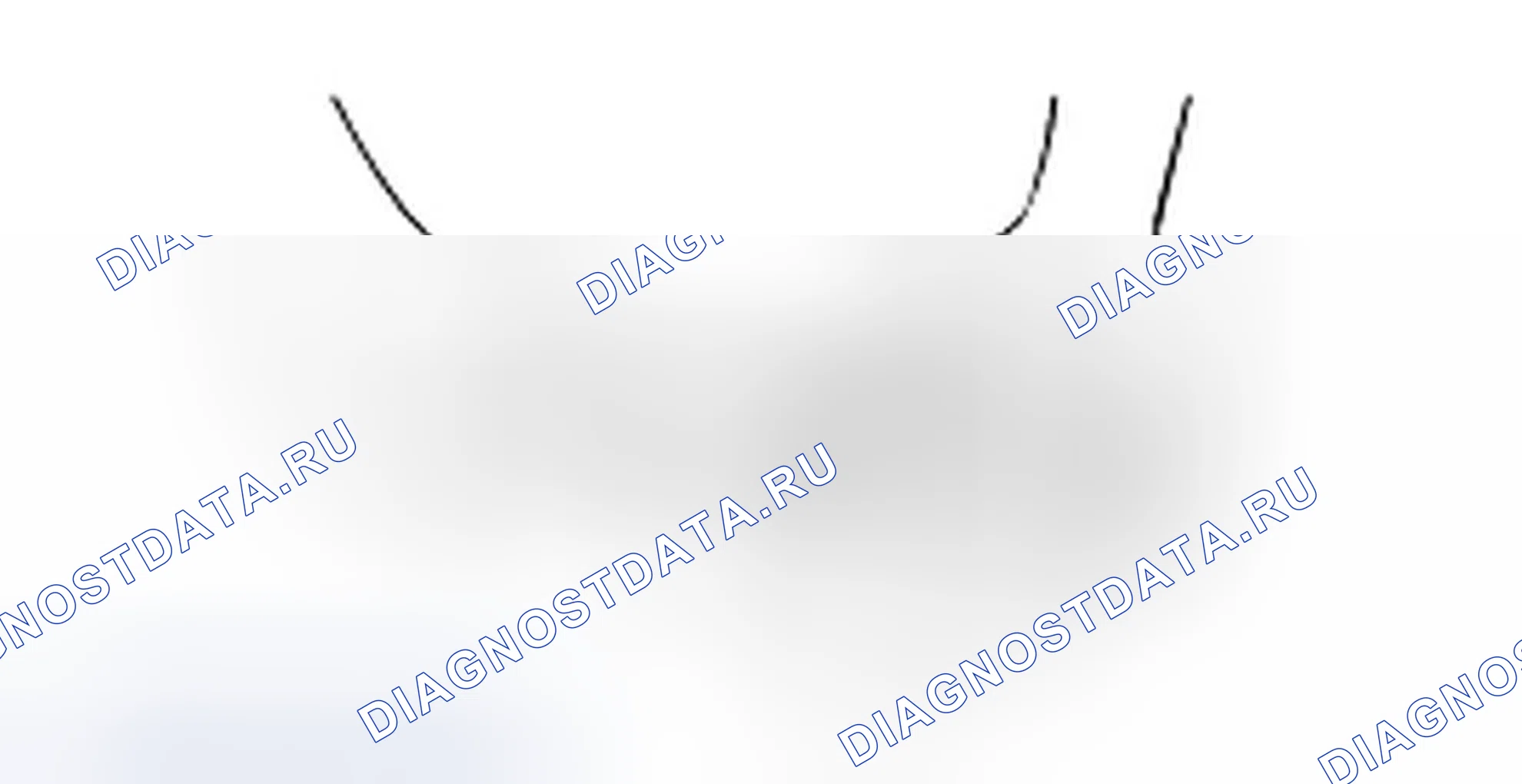 Проверка масляного насоса. Hyundai H-1 A1