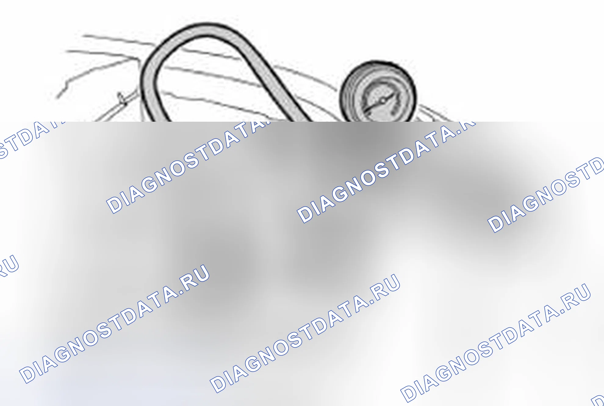 Рис. 2: ОПРЕССОВКА СИСТЕМЫ ОХЛАЖДЕНИЯ. Land Rover Range Rover Sport L320