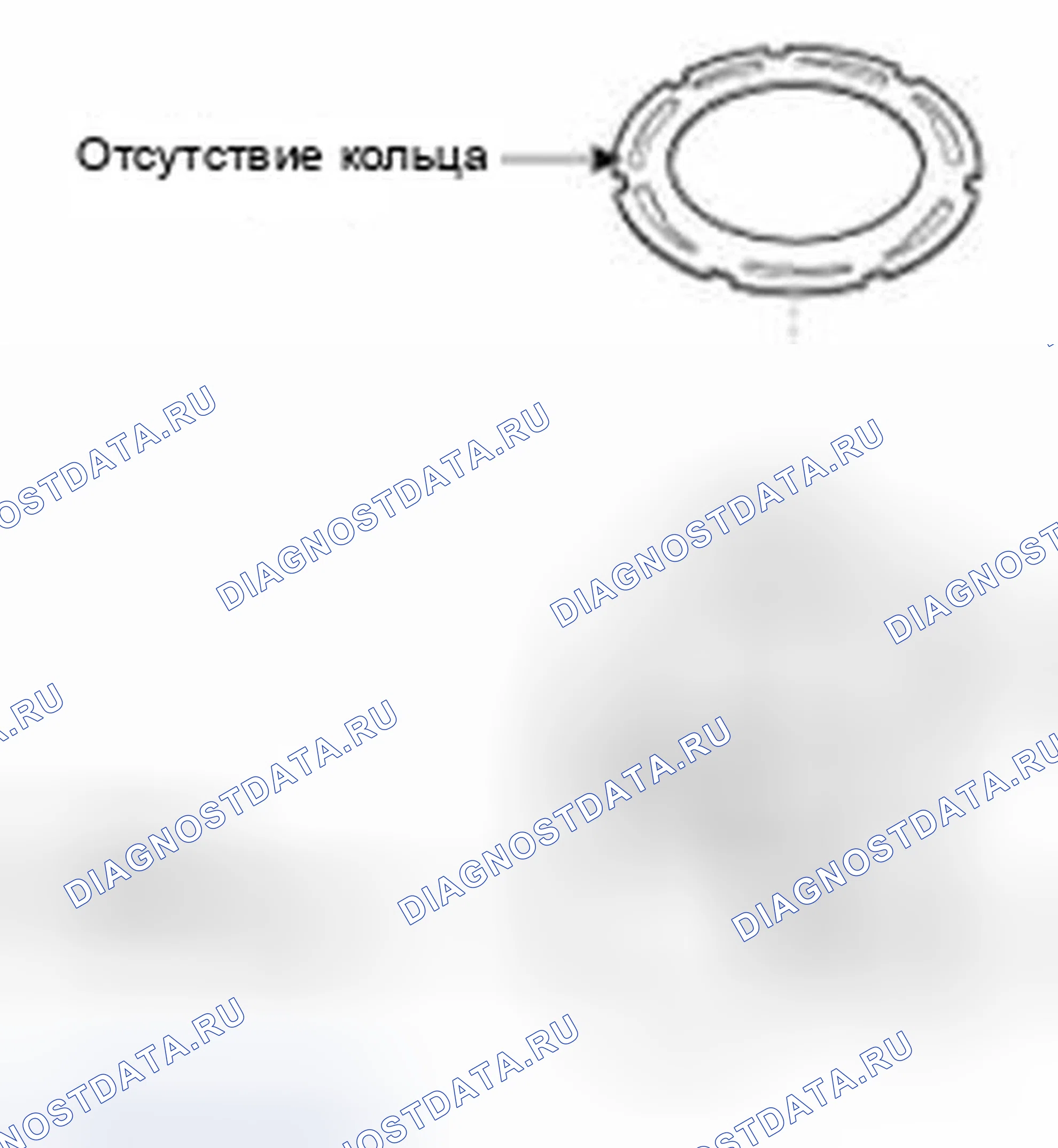 Рис. 24. Hyundai Elantra V