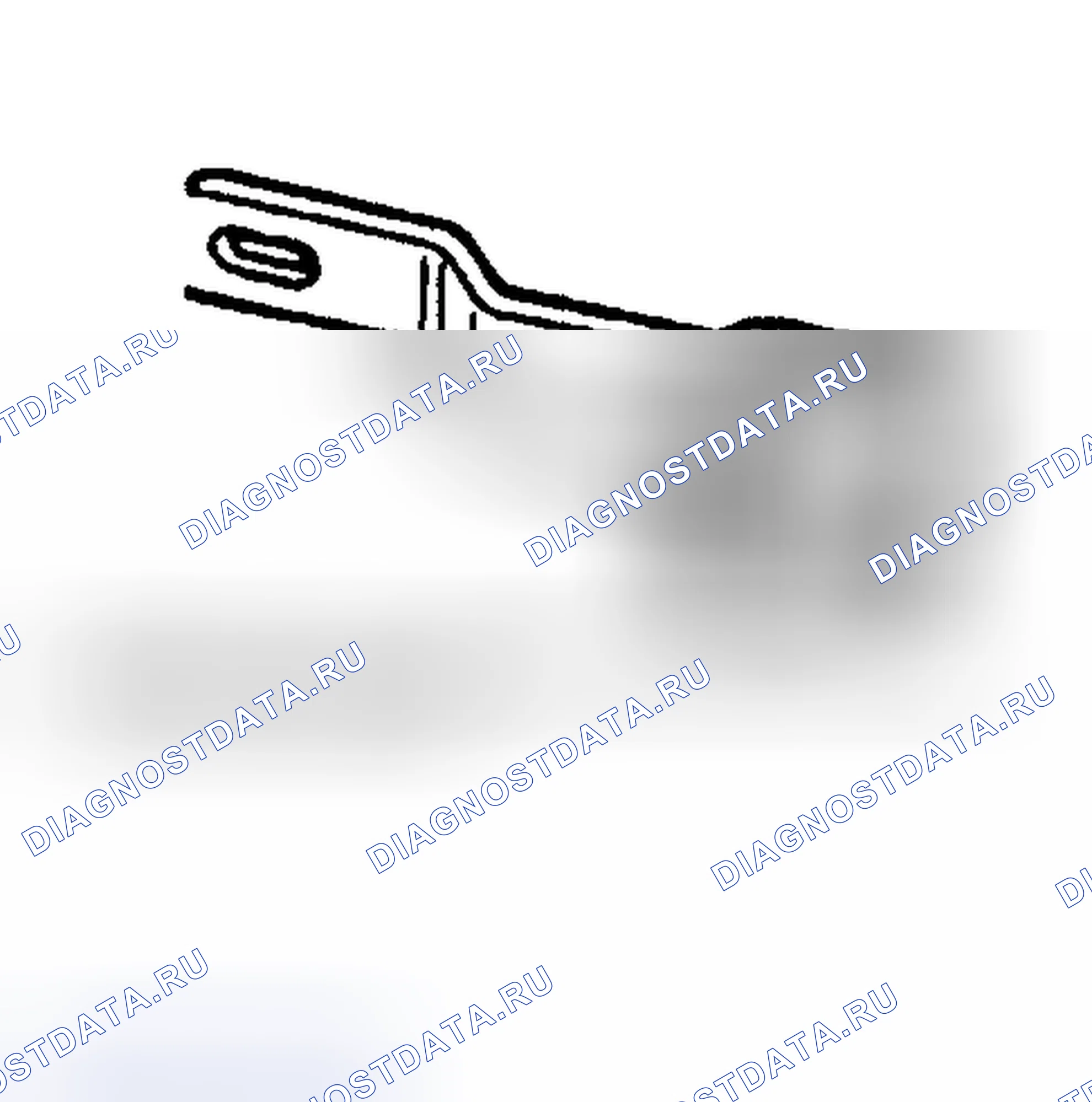 Рис. 10. Hyundai Lantra II