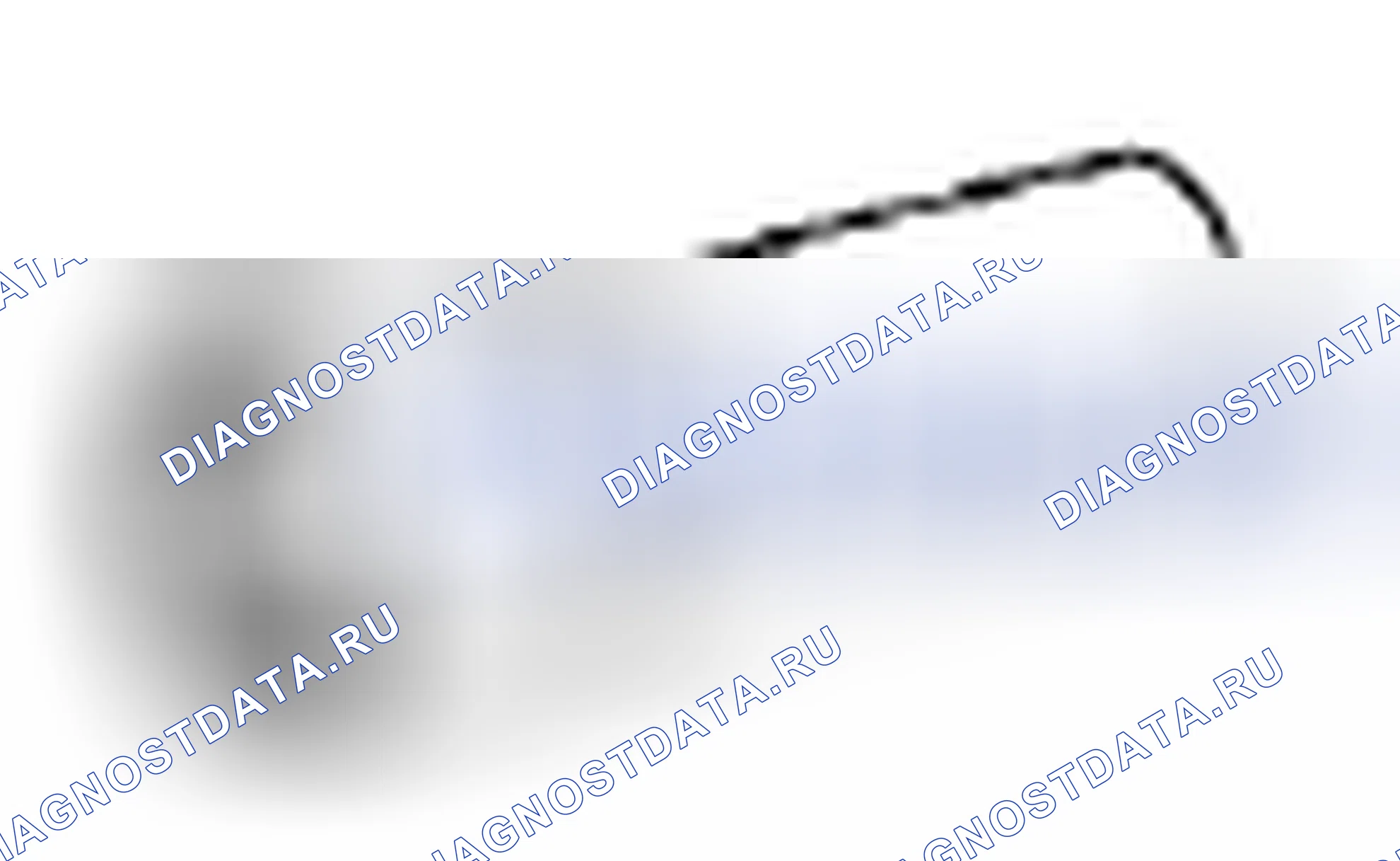 Рис. 175: SST. Toyota Corolla X
