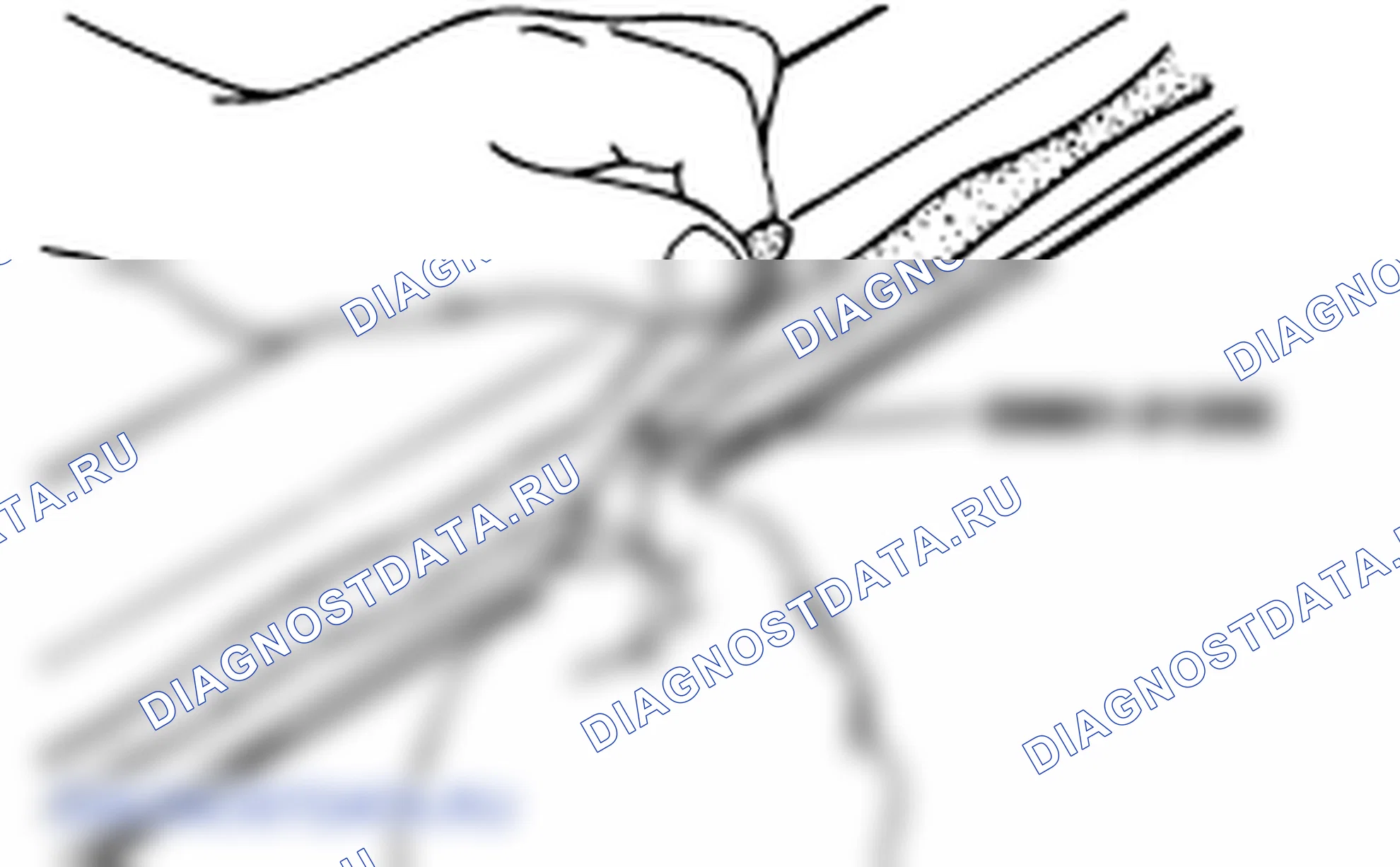 Установка ветрового стекла. Hyundai Accent LC