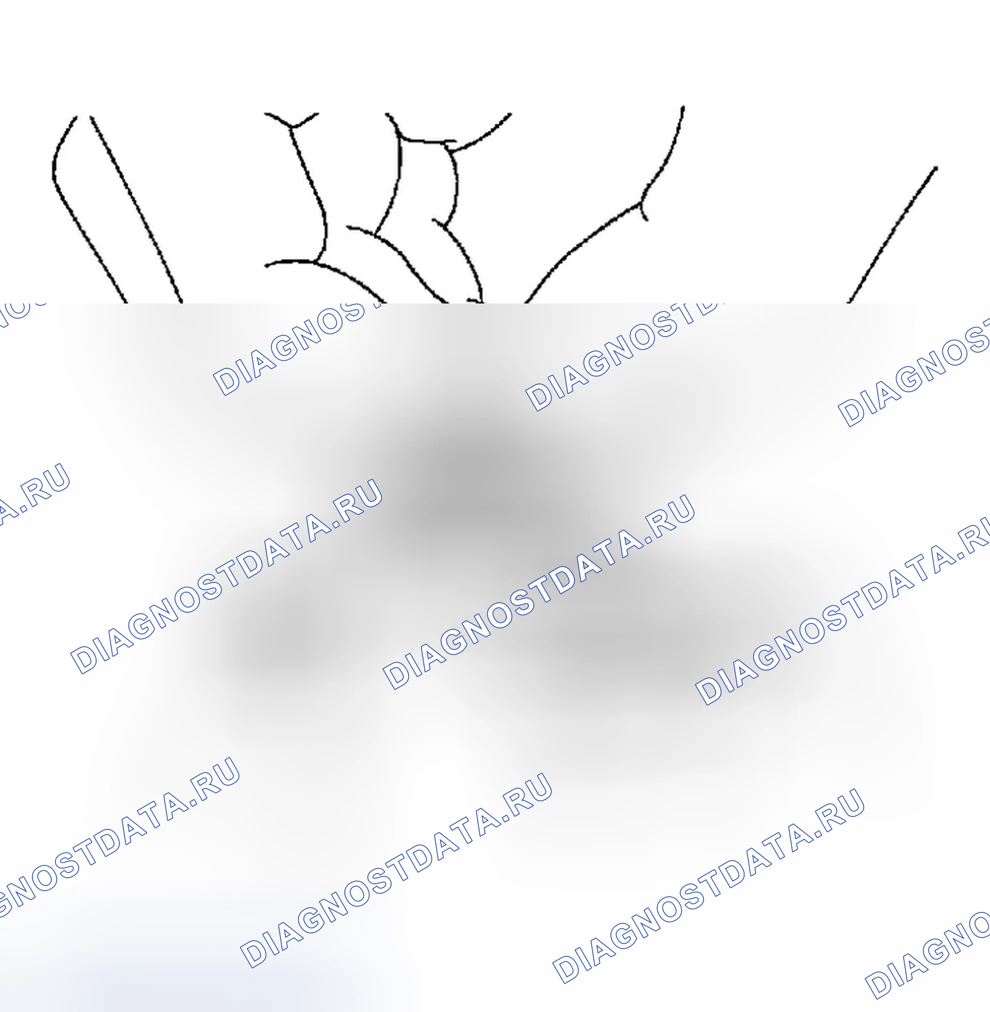 Рис. 1: ПРОВЕРКА КРЫШКИ РАДИАТОРА. Infiniti FX35 I