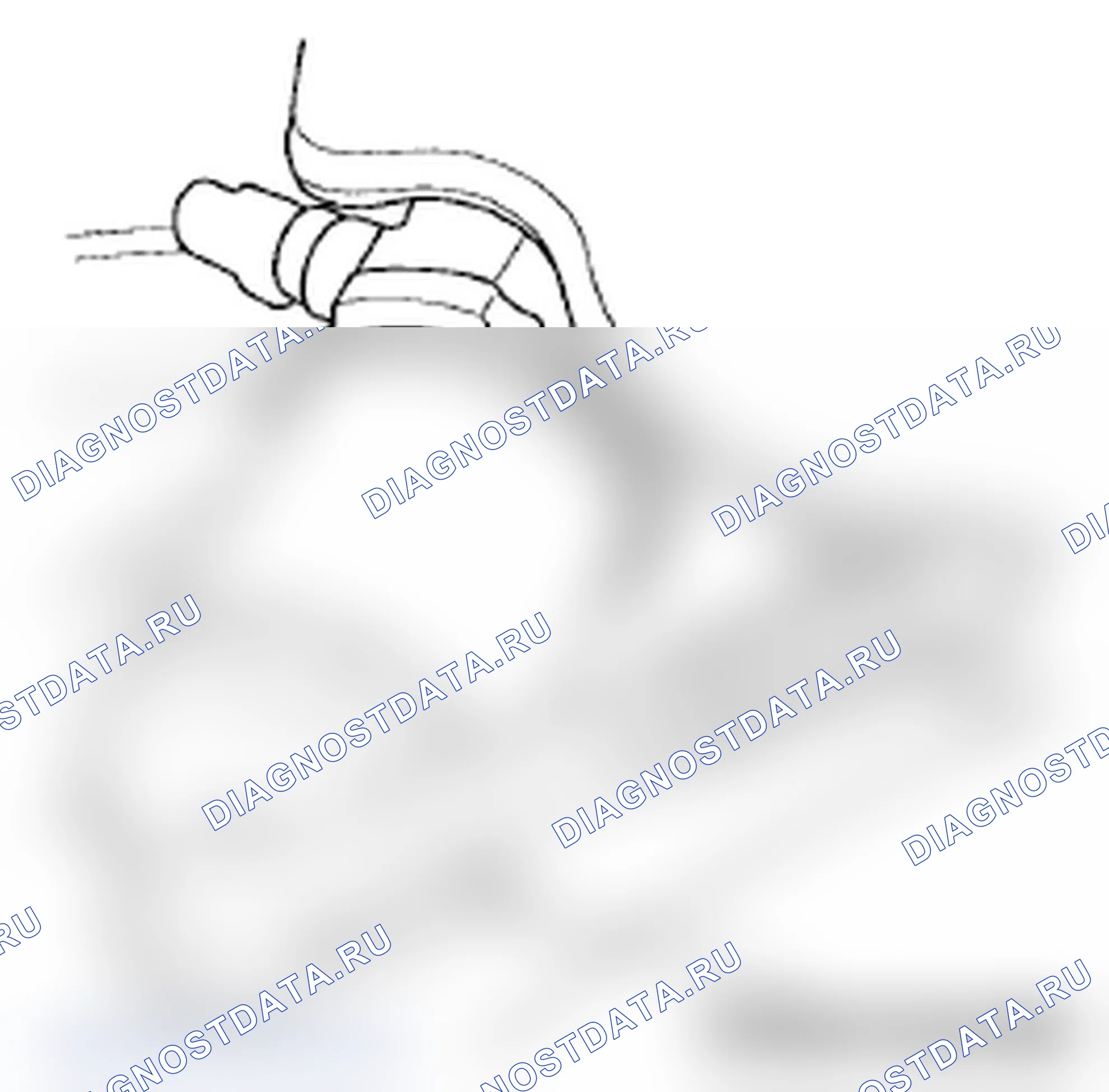 Рис. 14. Acura RL II рестайлинг
