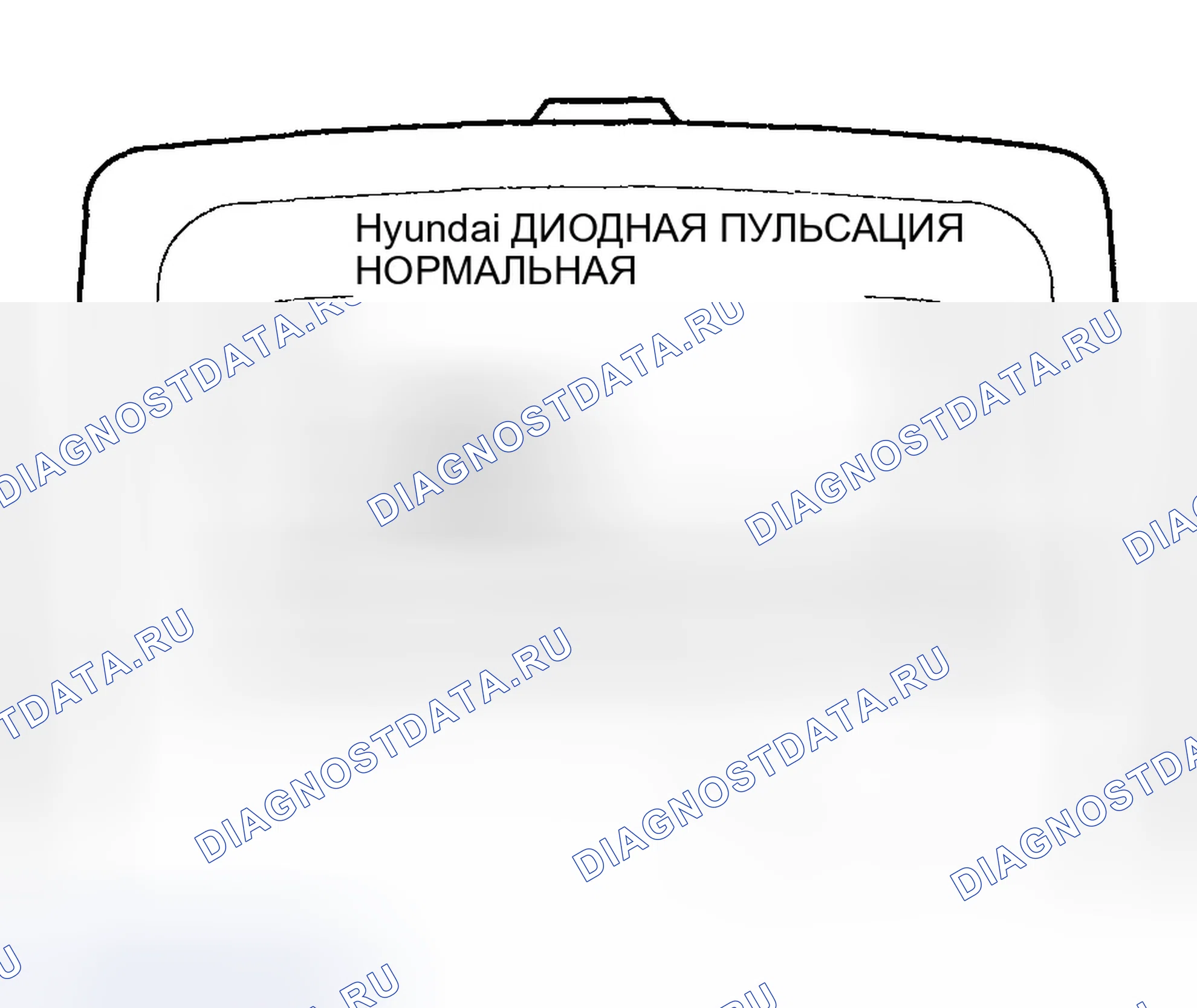 Рис. 24. Hyundai Elantra III рестайлинг