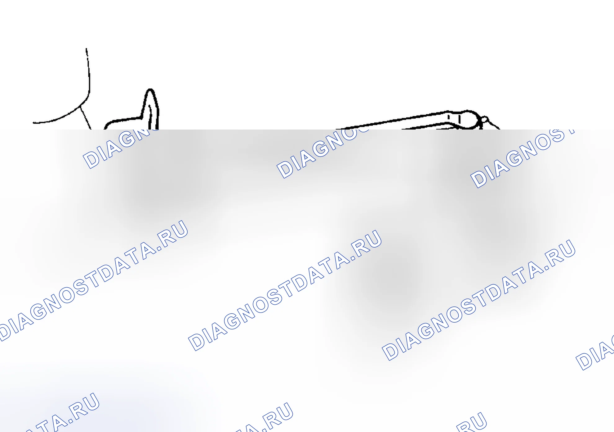 Рис. 20: Повторная сборка. Lexus ES V20