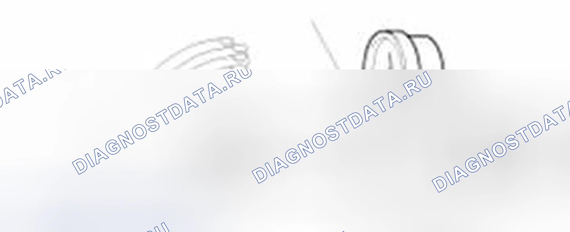 Рис. 157: Испытание крышки радиатора. Hyundai Sonata VI