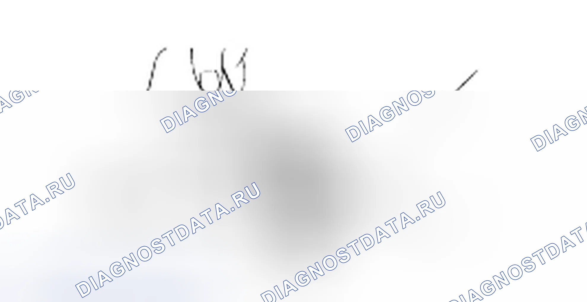 Разборка планетарной передачи. Hyundai H-1 A1