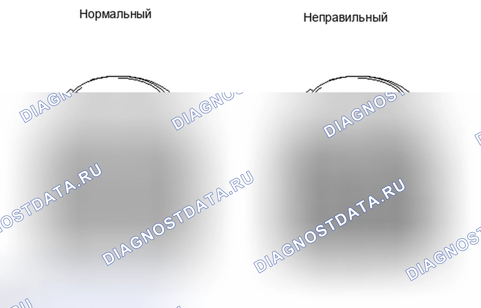 Рис. 30: КРОВОТЕЧЕНИЕ. Haval H4 I