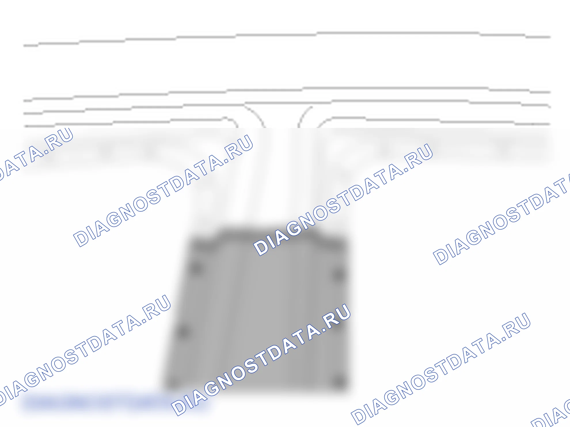 Установка центральной колонны. Hyundai ix35 EL