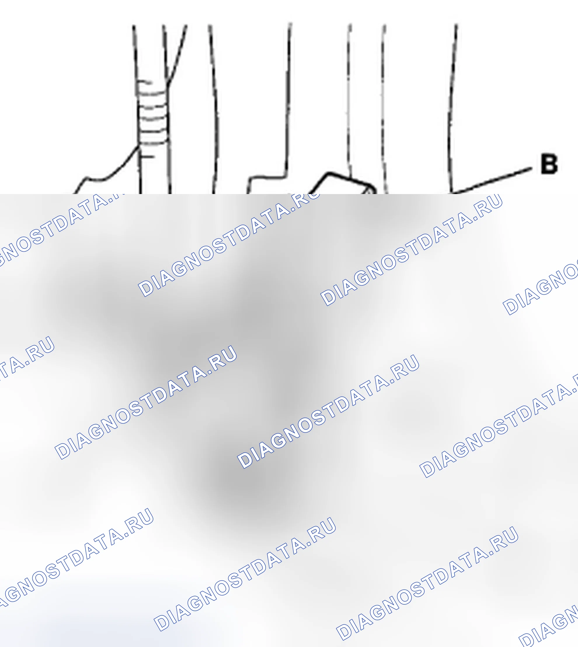 Рис. 546: Удаление. Honda Civic VIII