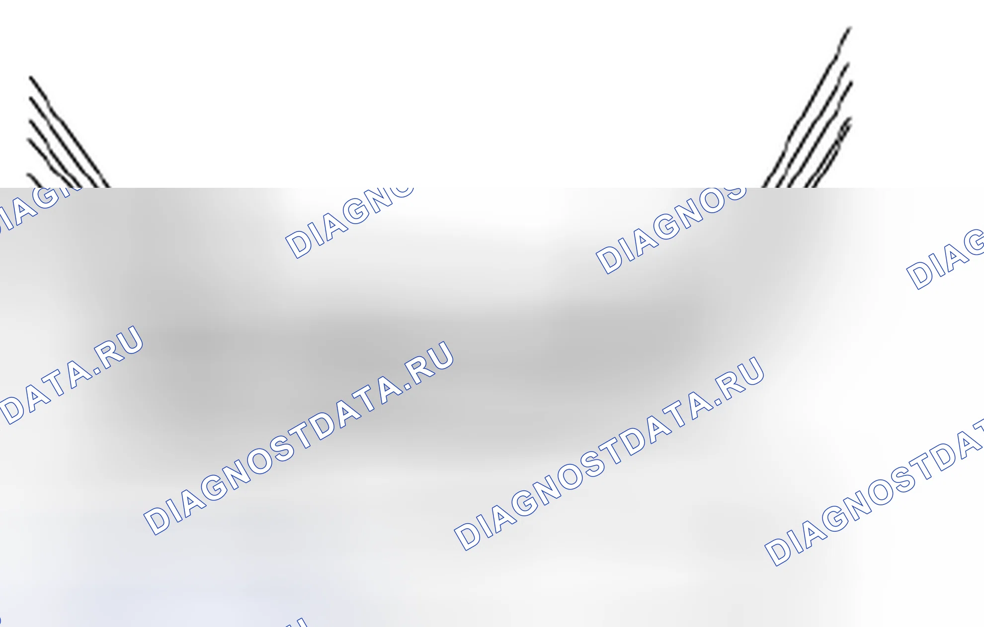 Рис. 4: Демонтаж. Suzuki Forenza I