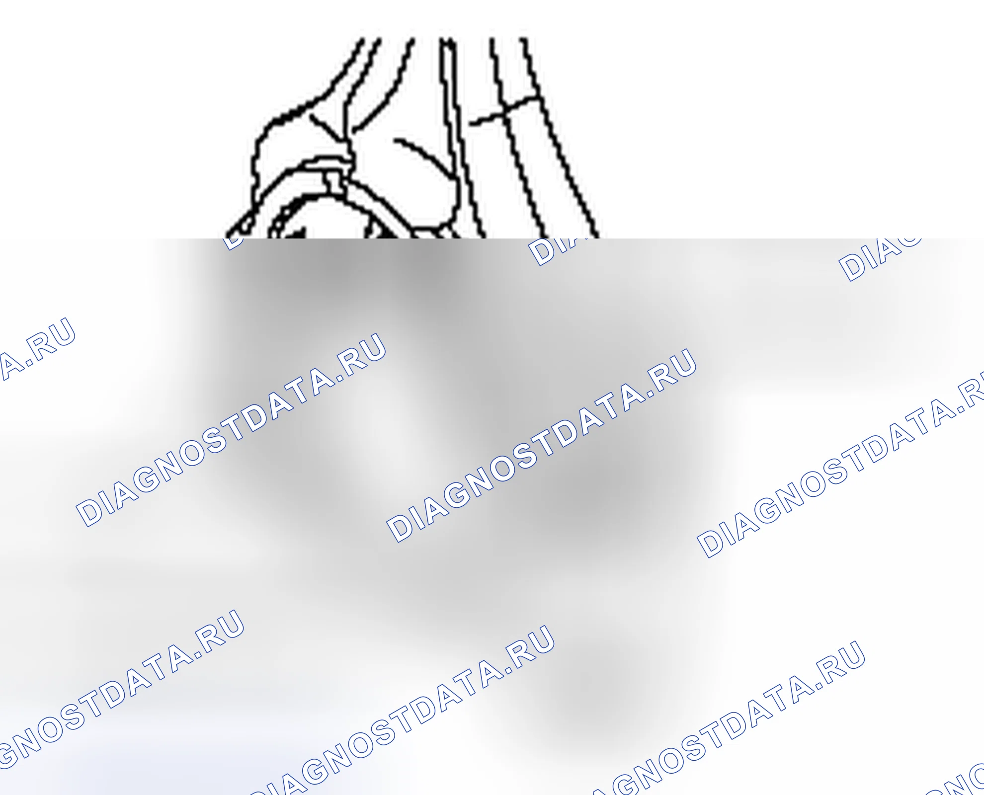 Рис. 110: > > F < < УСТАНОВКА КРЫШКИ ШАТУНА. Honda e:NP1 I