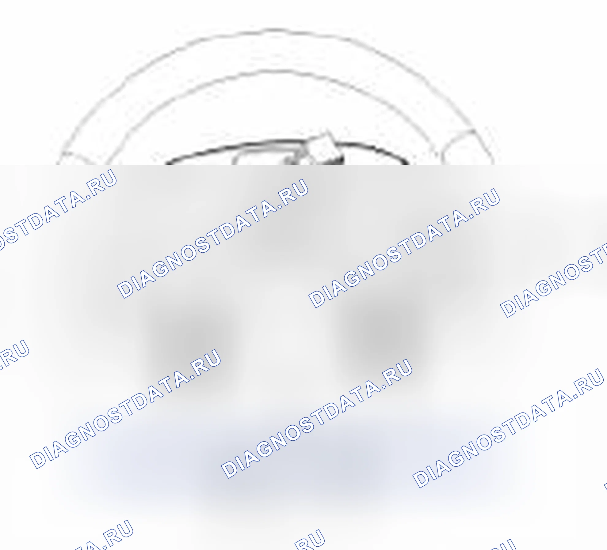Рис. 11: Демонтаж и монтаж. Geely Vision X3 Pro I