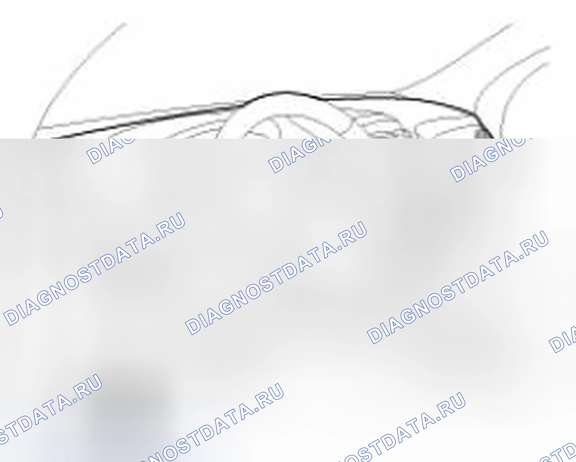 Рис. 151: Регистрация кода передатчика (с использованием GDS). Hyundai Tucson II