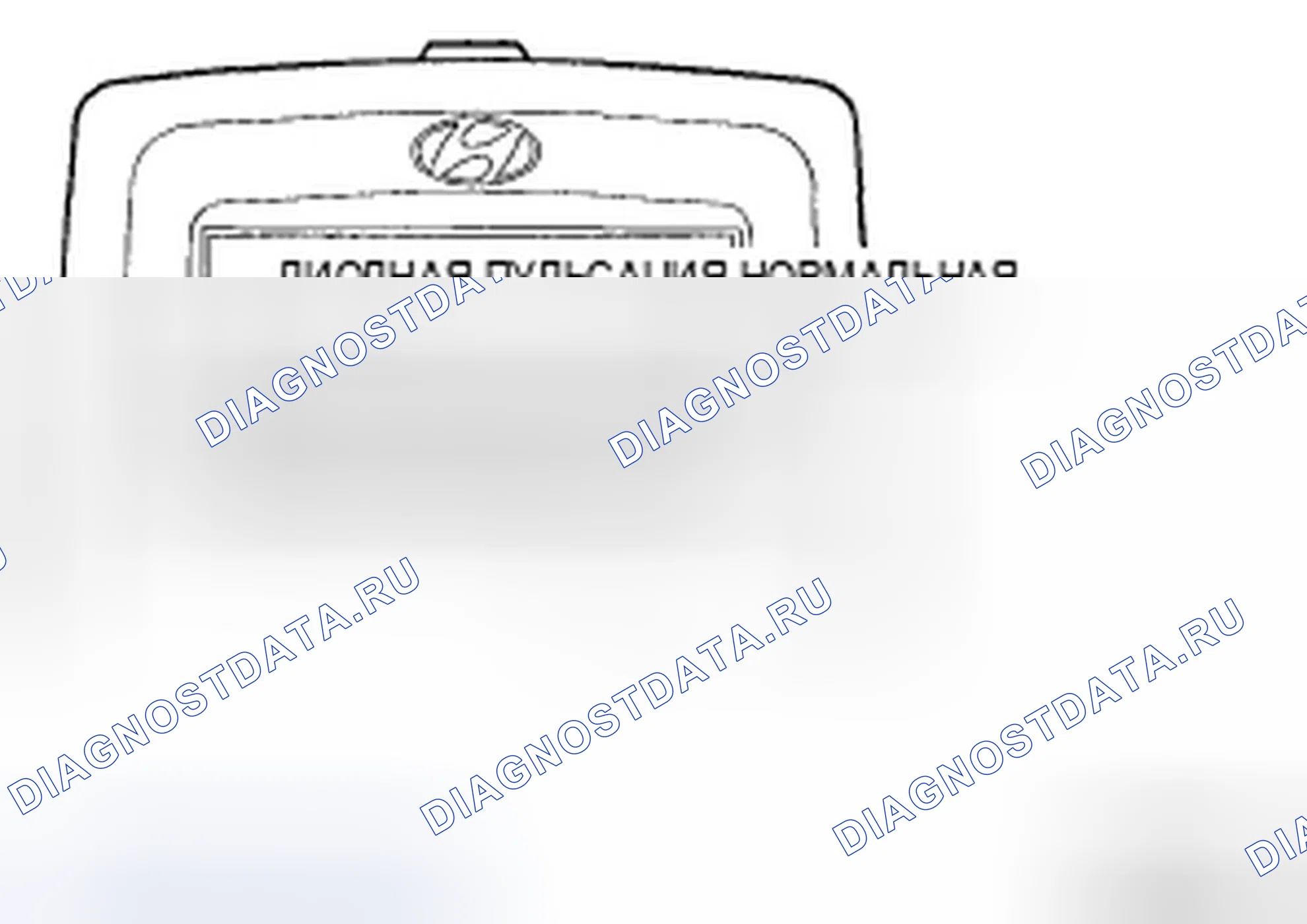 Рис. 43. Hyundai Accent III