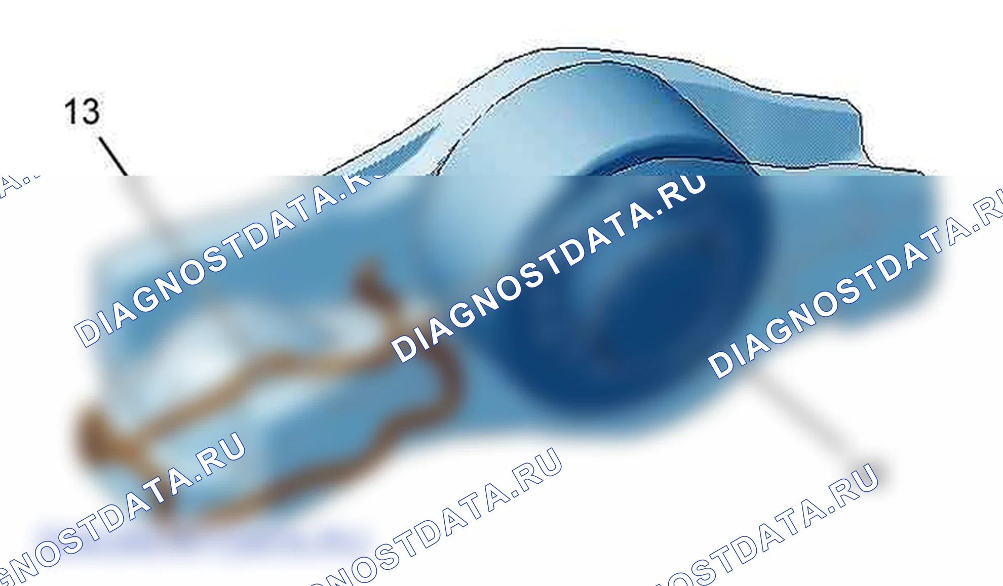 Снятие - Установка: Распределительные валы — b1dg07kd. Citroen Berlingo II
