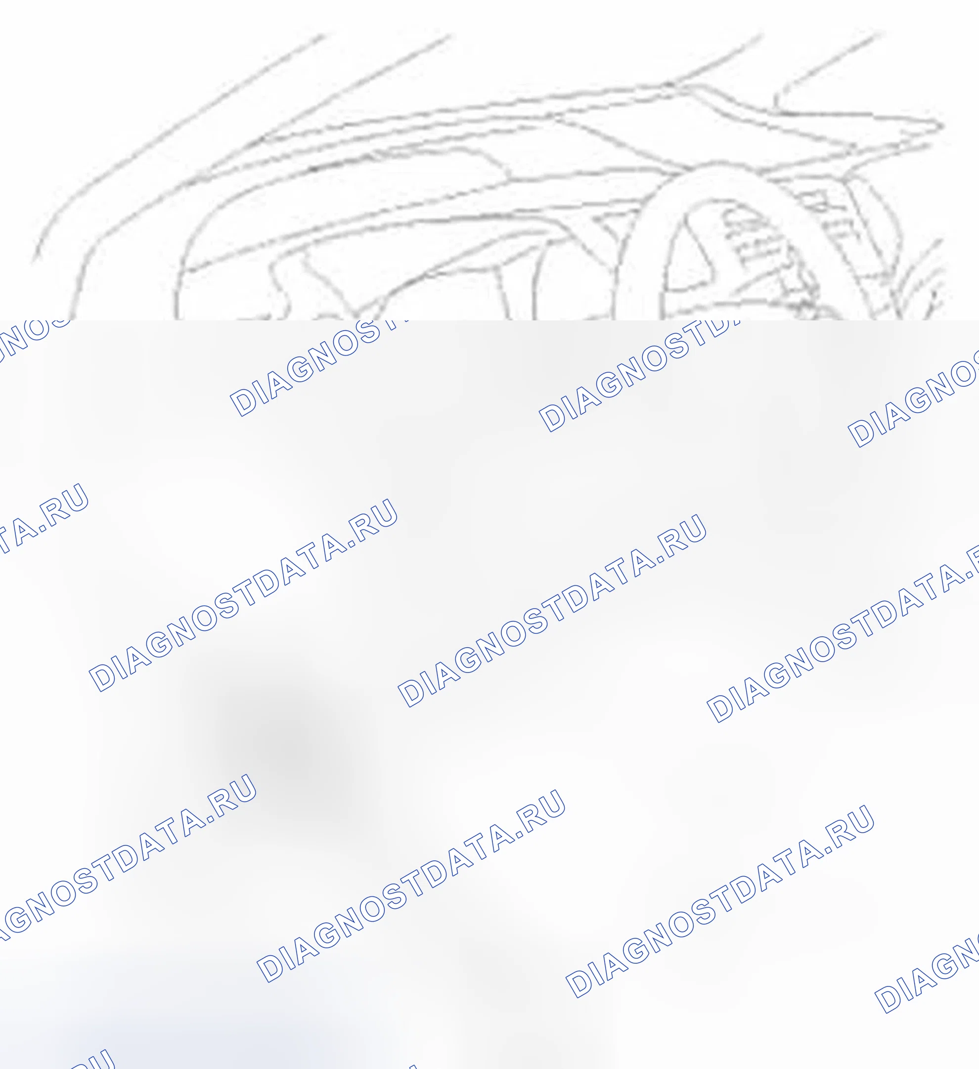 Рис. 27: Процедура. Honda Civic IX