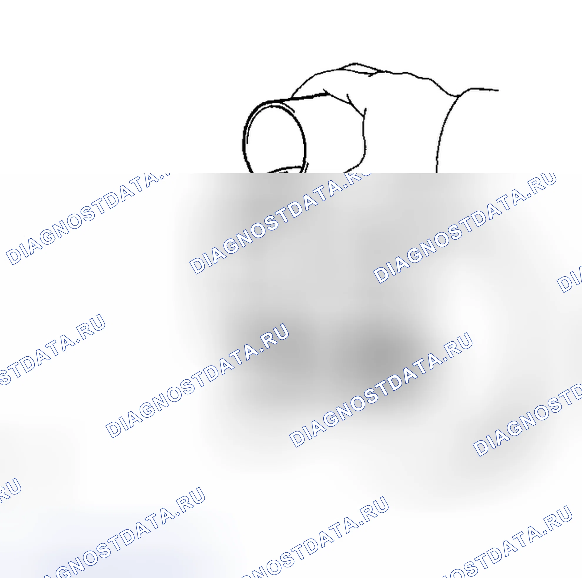 Рис. 129: КРОВОТЕЧЕНИЕ. Toyota Matrix E130