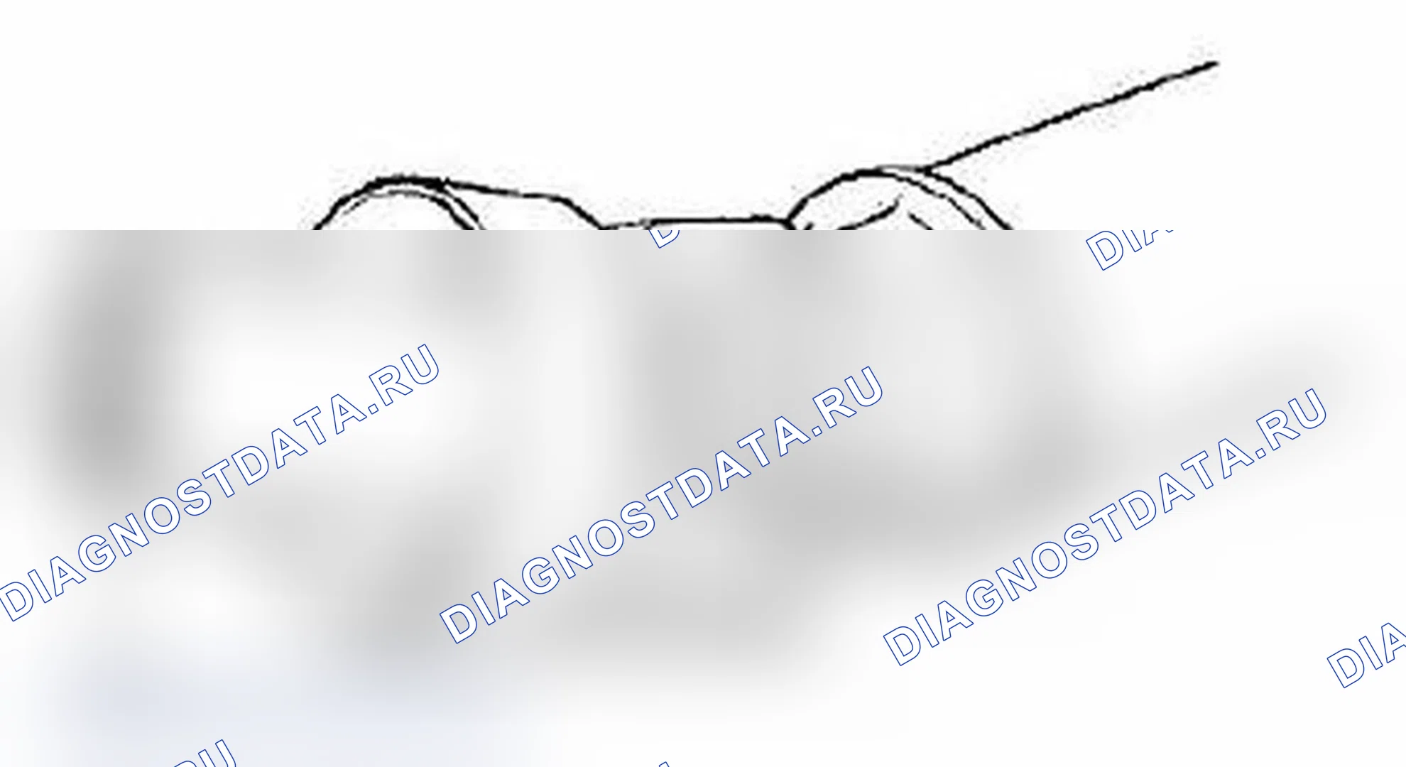 Рис. 4: Установка. Suzuki Grand Vitara II