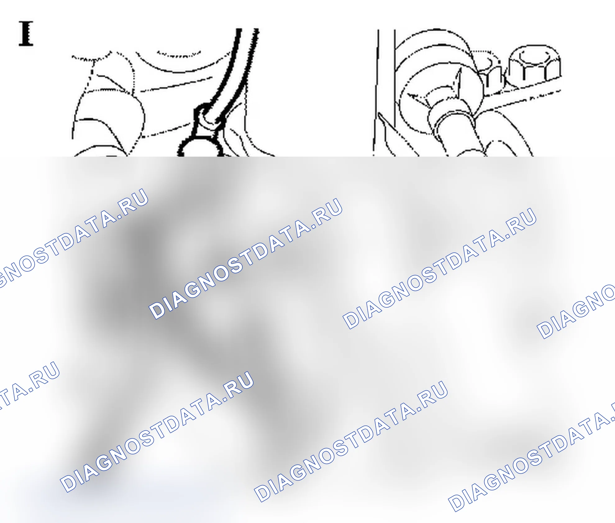 Cracking noise from front section - Temporary cracking noise from front section. Opel Signum I рестайлинг