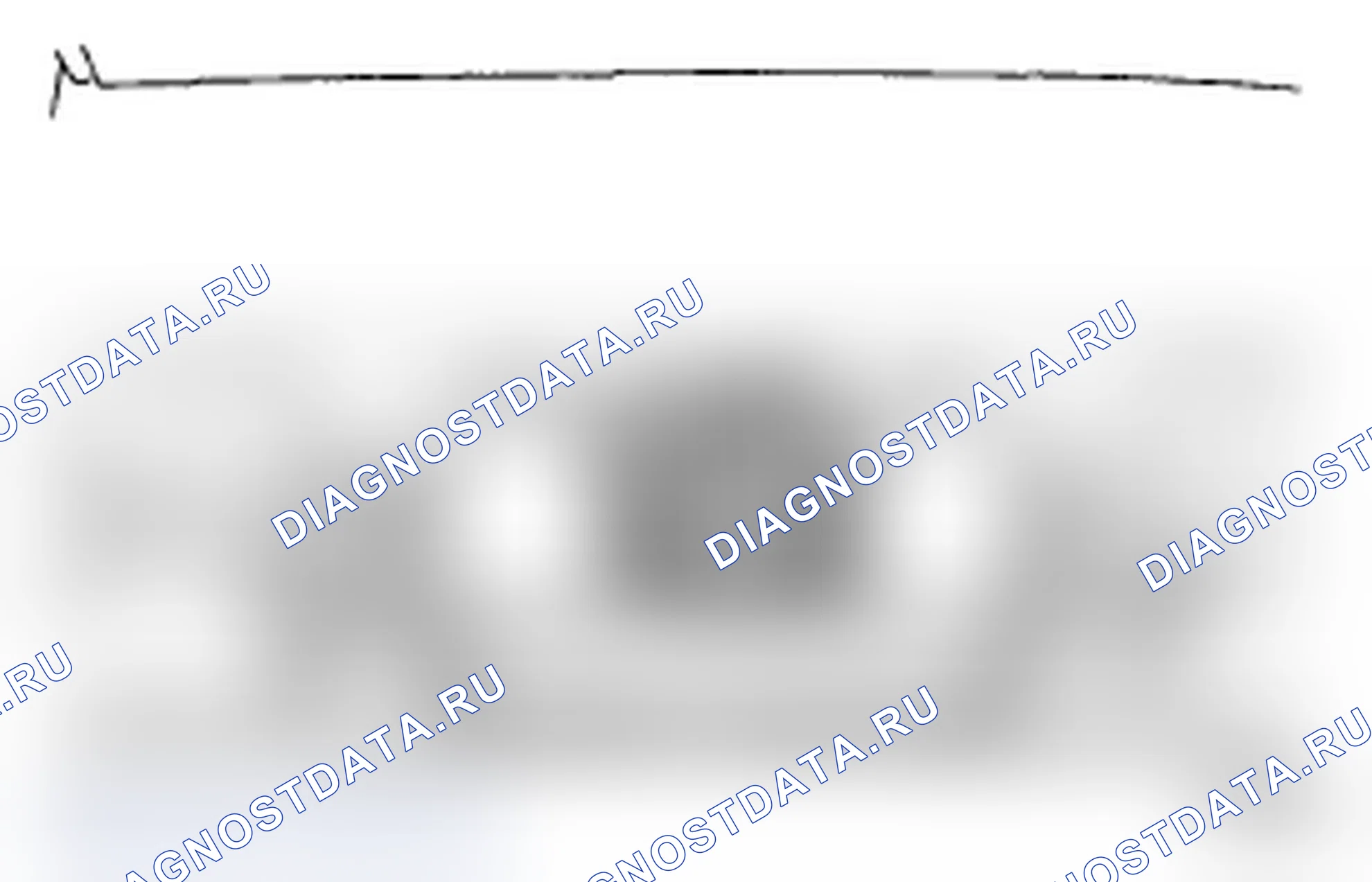 Рис. 158: ДЕМОНТАЖ. Toyota Land Cruiser 200