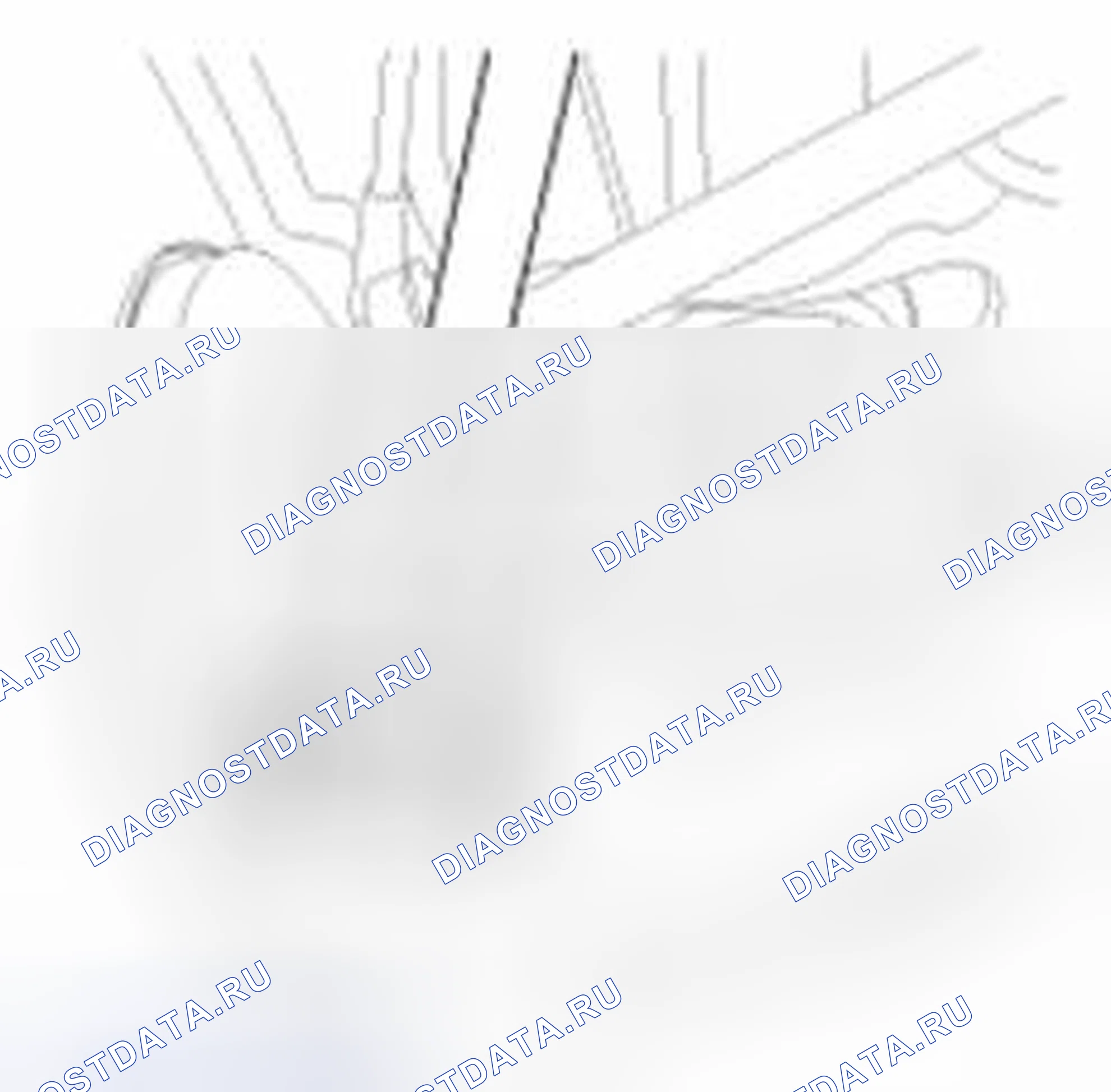 Рис. 12: Замена. Geely SC7 I