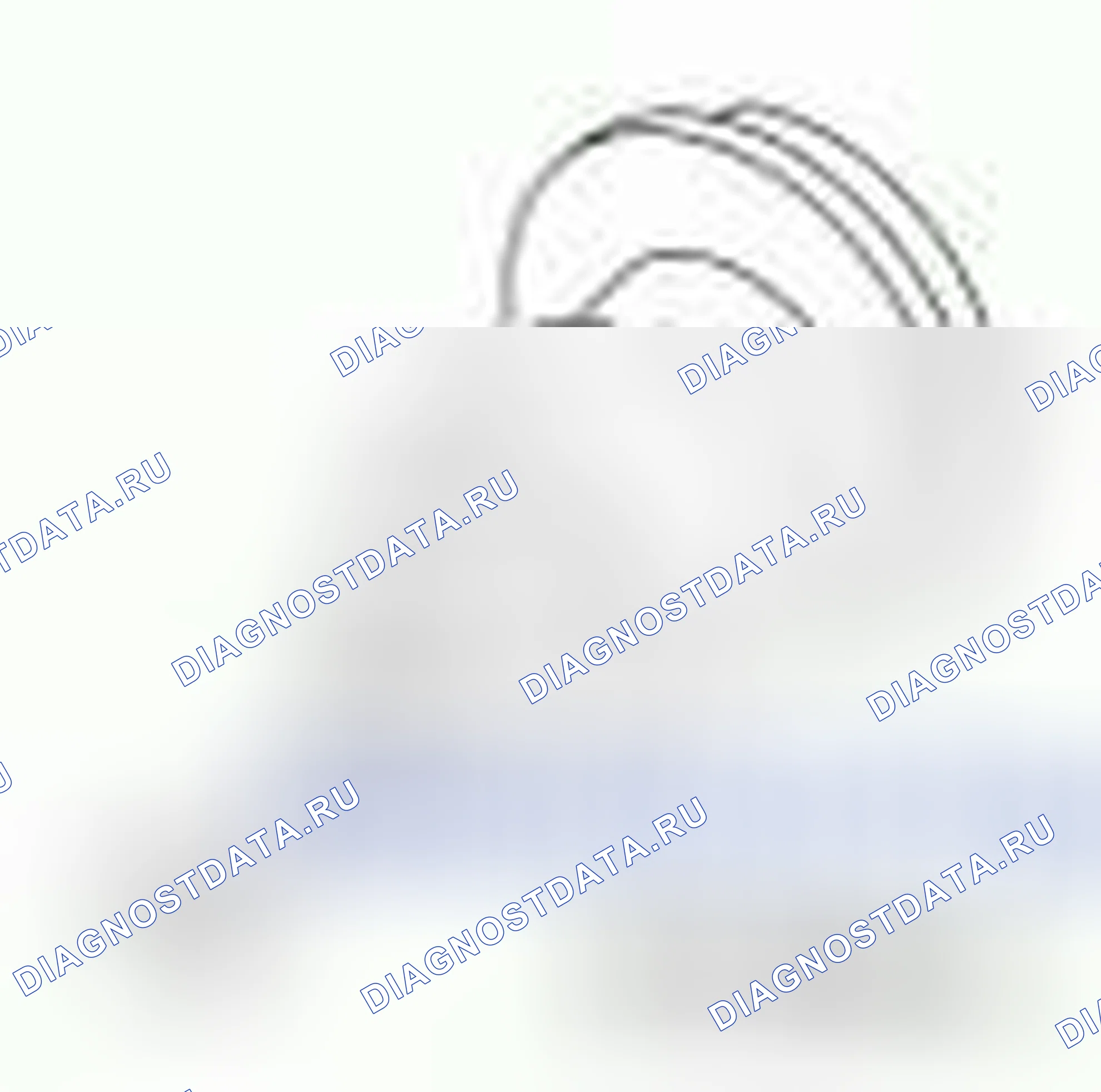 Рис. 1389. Hyundai ix55 I