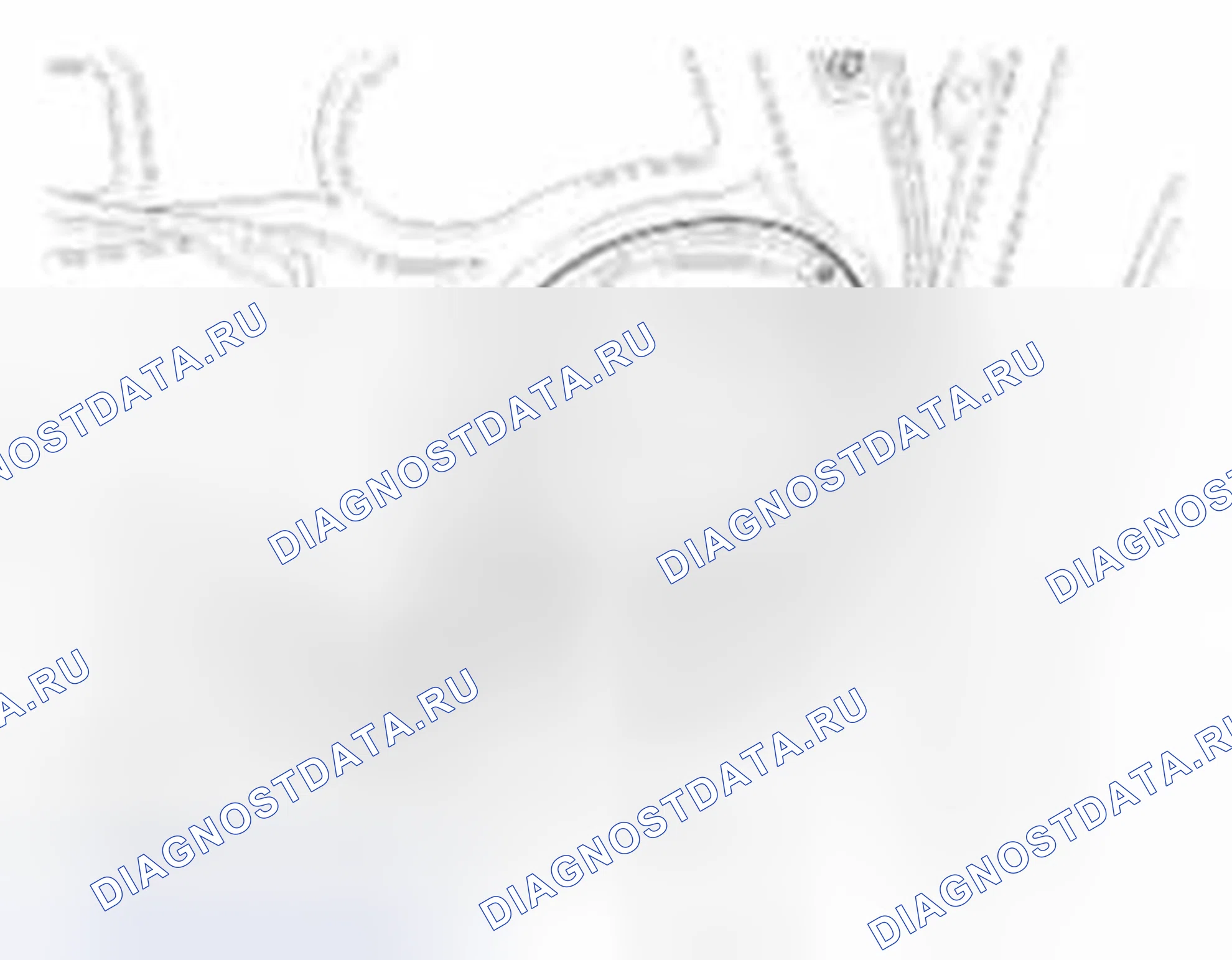Рис. 9: Задний динамик. Hyundai Veracruz I
