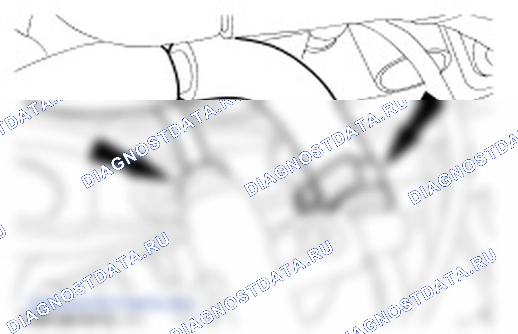 Как снять и установить Водяной насос в сборе — Снятие и установка (24 404 0). Ford Mondeo I