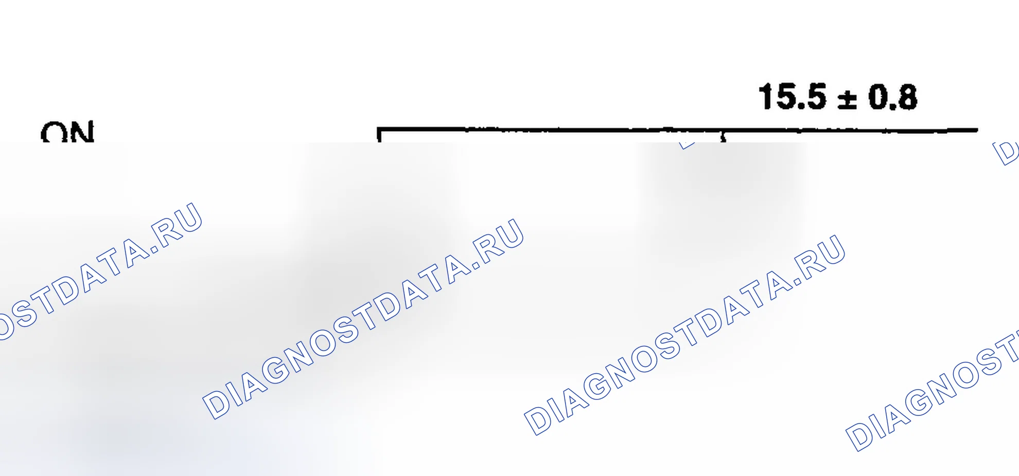 Рис. 5. Hyundai Elantra III рестайлинг