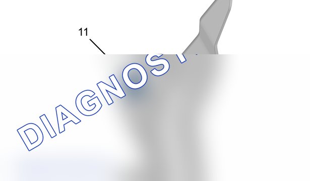 Снятие - установка: педальный узел — b3fg2lsd. Peugeot 308 II