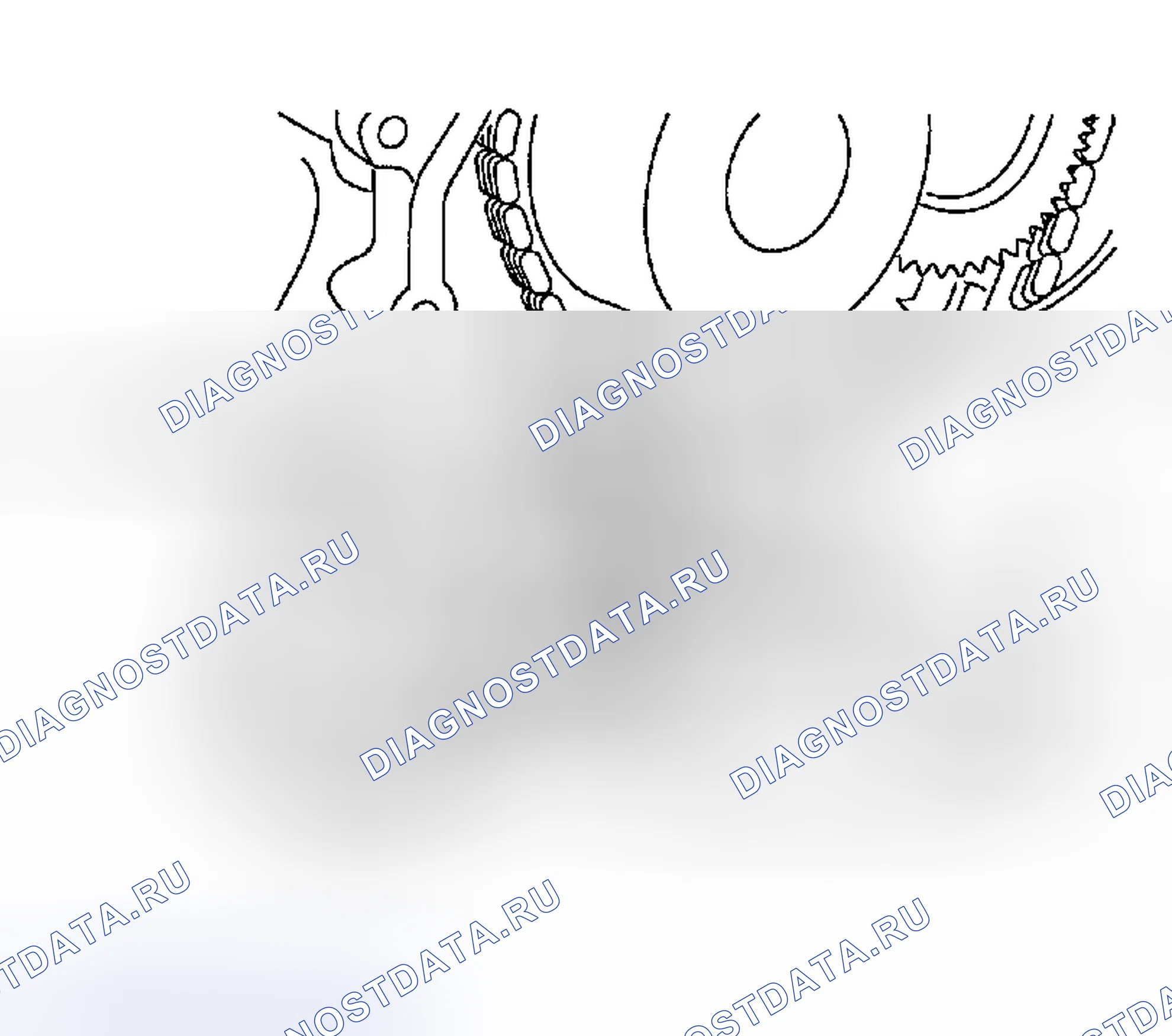 Рис. 194. Nissan Sentra B15