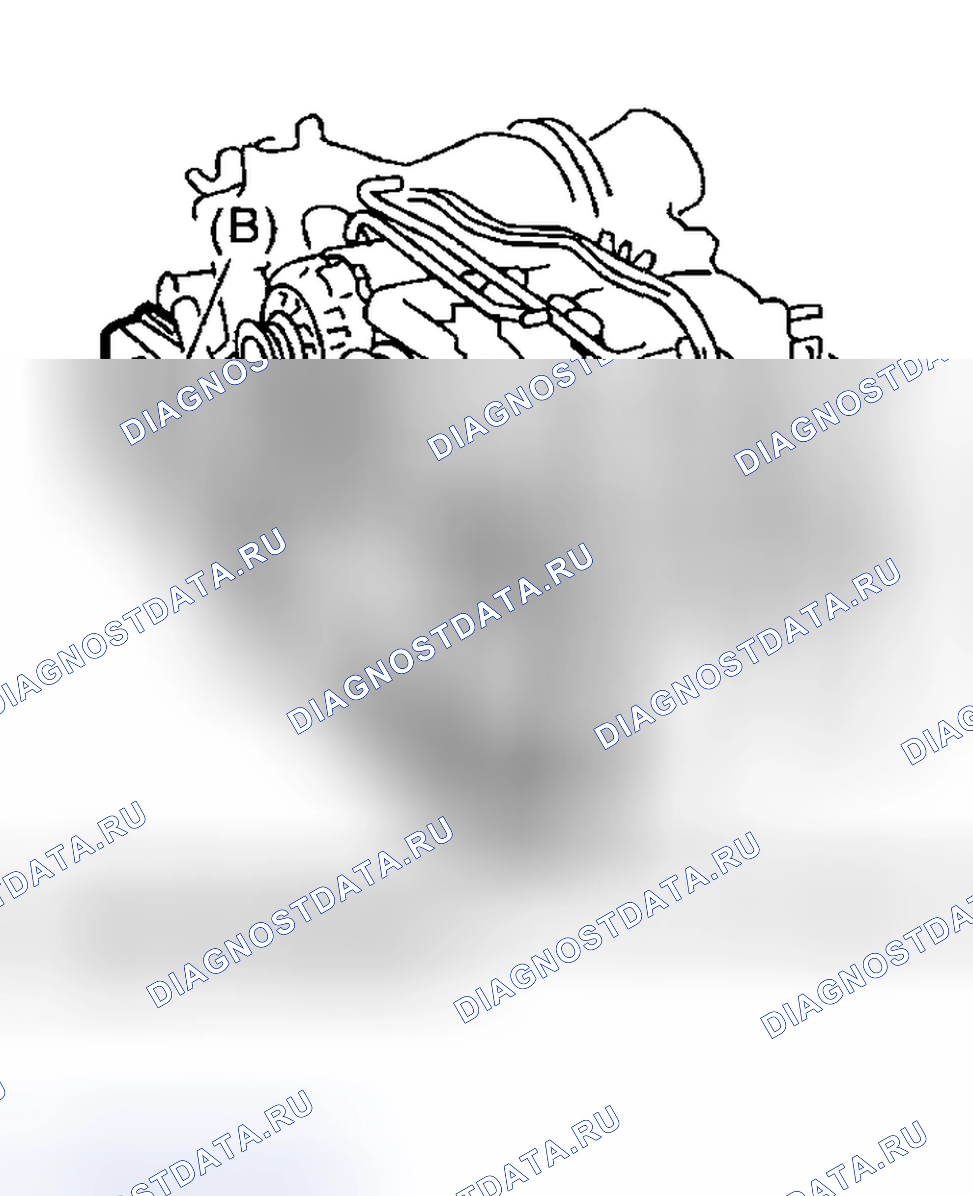 Рис. 75: УДАЛЕНИЕ. Honda WR-V I
