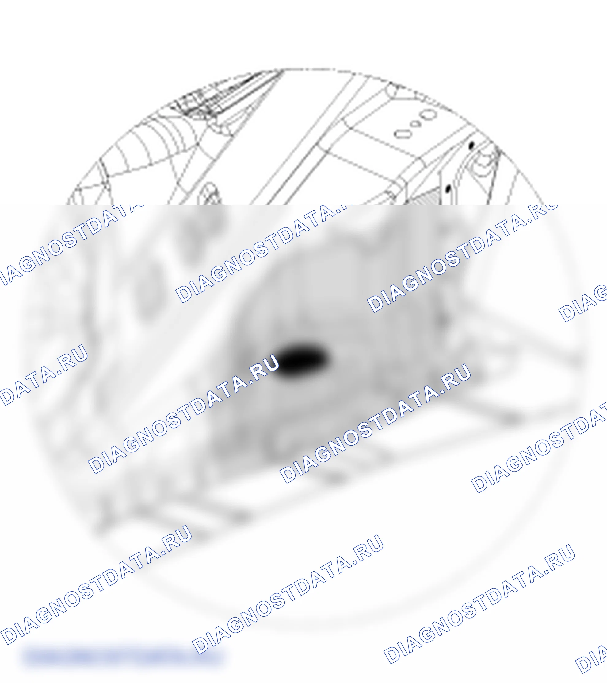 Под покрытием. Hyundai Genesis Coupe(Bk)-U.S. I