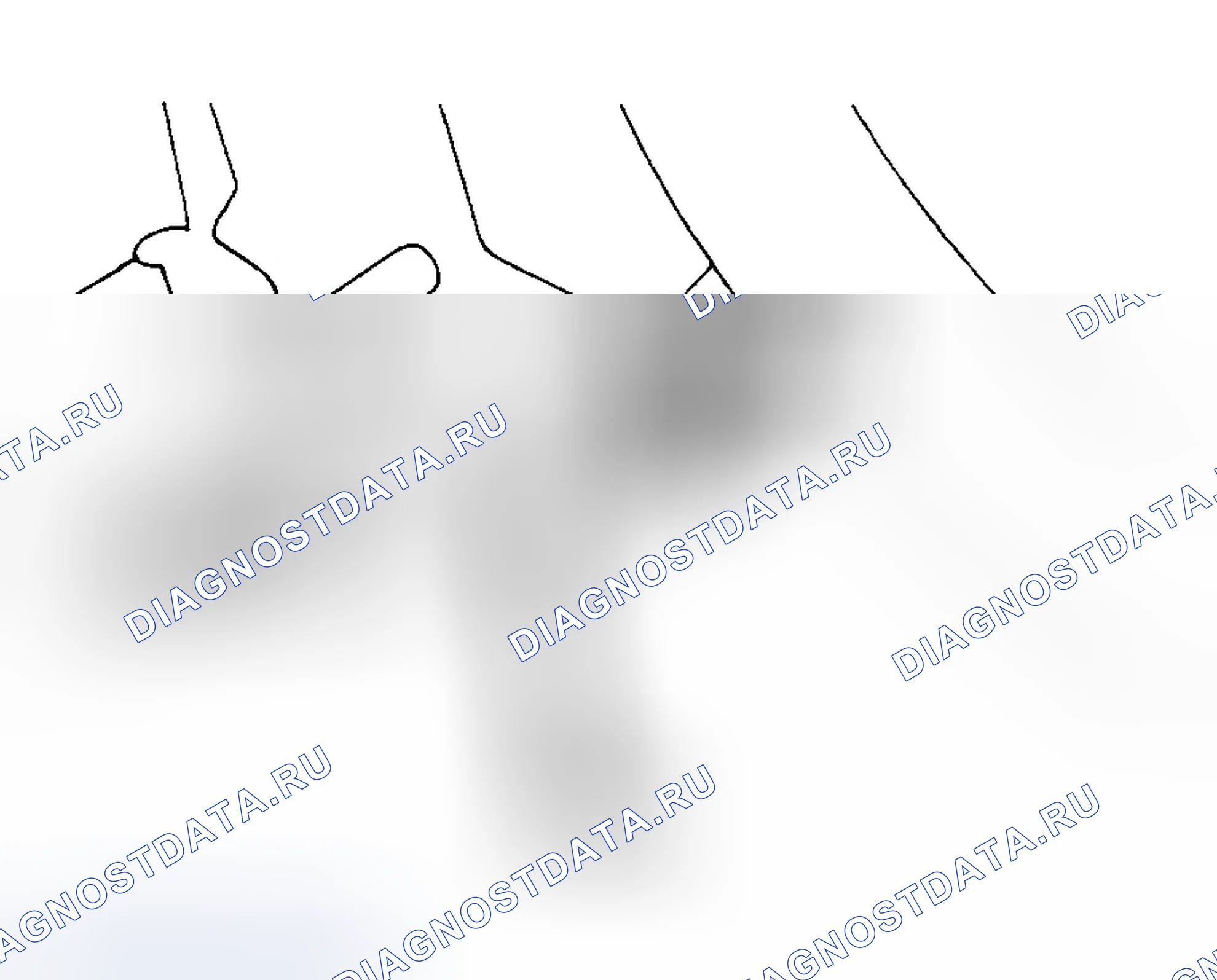 Рис. 15. Eagle Summit I